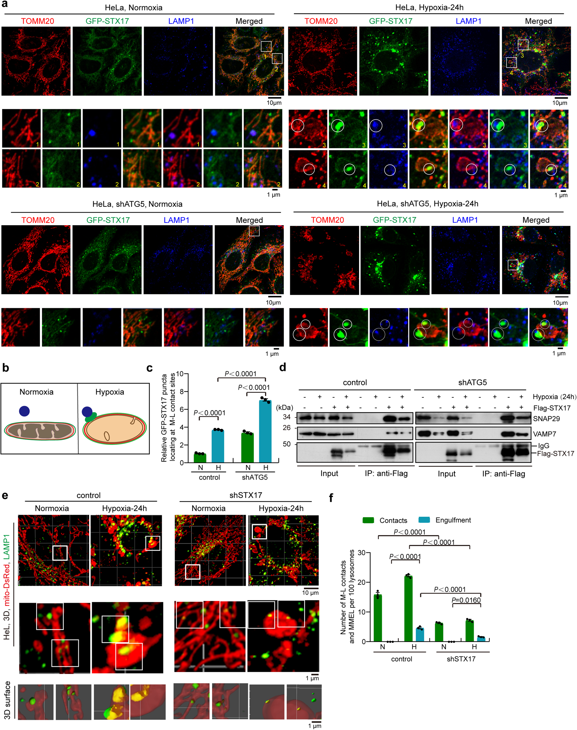 Fig. 4: The role of STX17-SNAP29-VAMP7 complex in the mitochondria-lysosome contacts and MMEL.