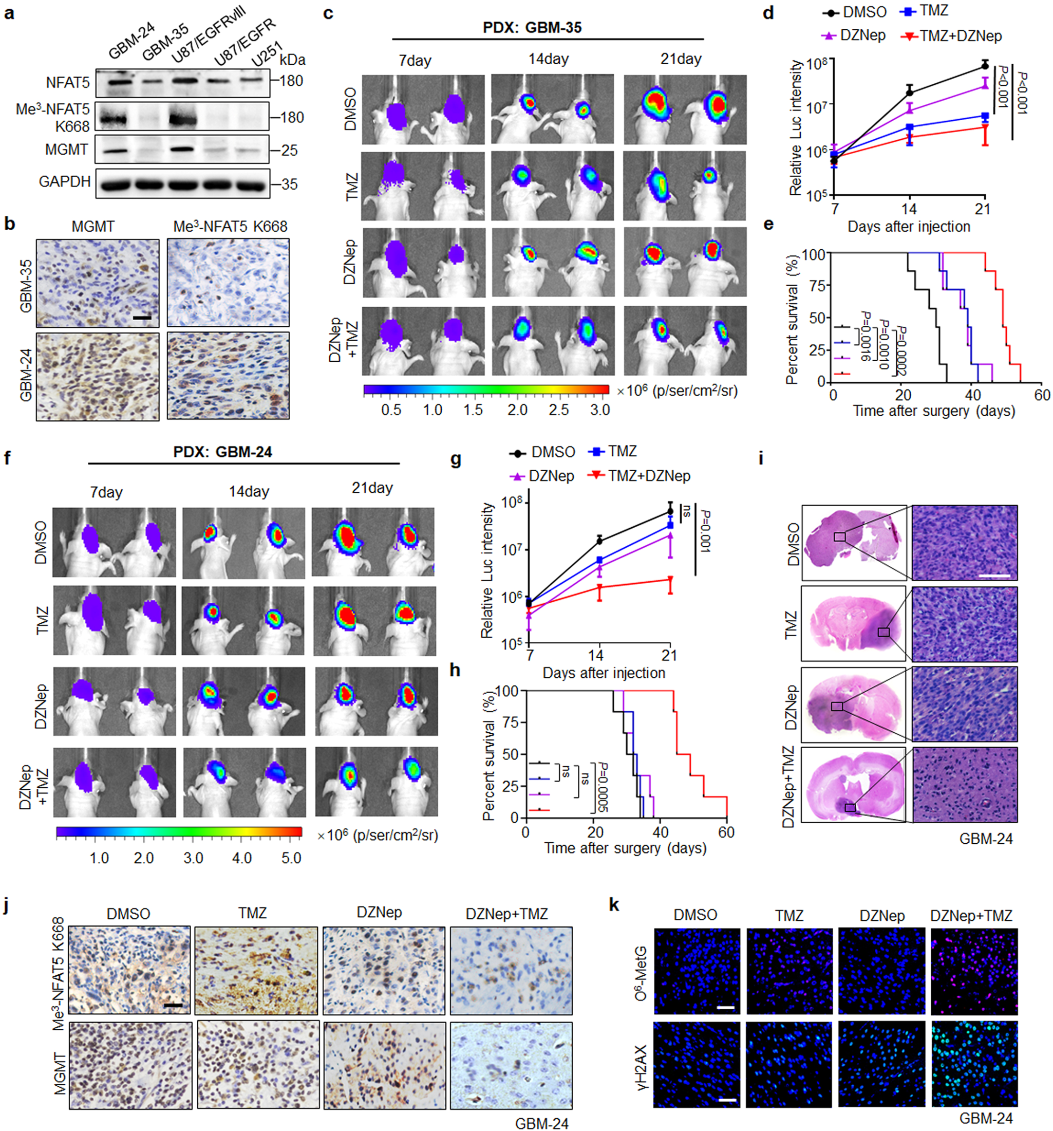 Fig. 8: NFAT5 K668 methylation status predicts TMZ efficacy in PDX models.