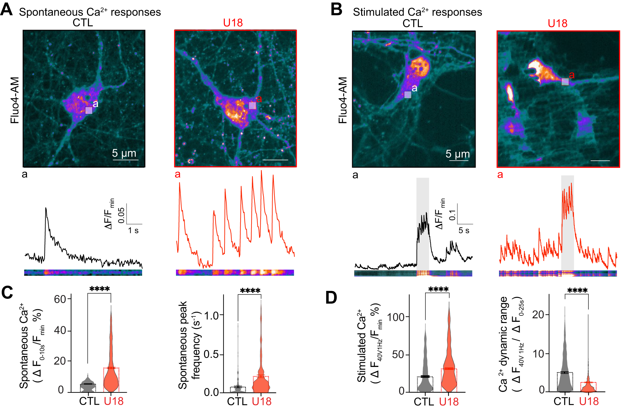 Niemann–Pick type C disease: cellular pathology and