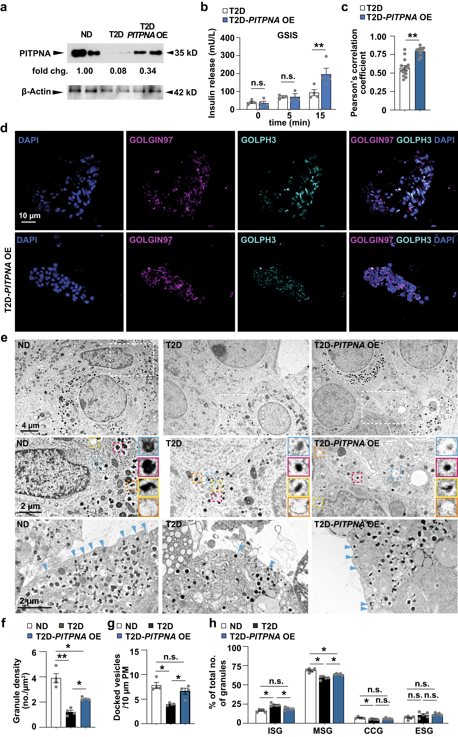 Fig. 7: Restoration of PITPNA in isolated islets of T2D human subjects rescues pancreatic beta-cell function.