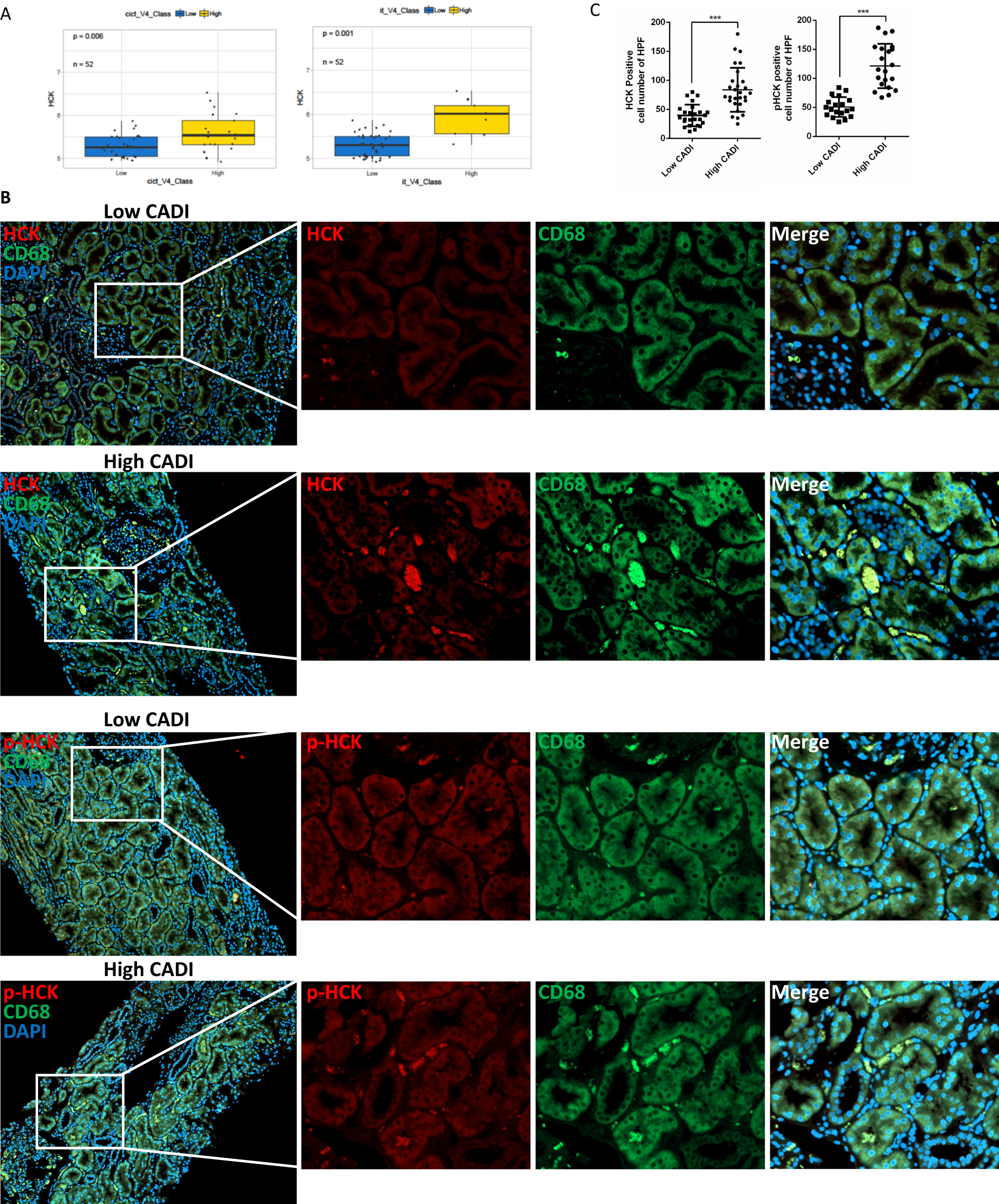 HCK induces macrophage activation to promote renal inflammation and  fibrosis via suppression of autophagy | Nature Communications