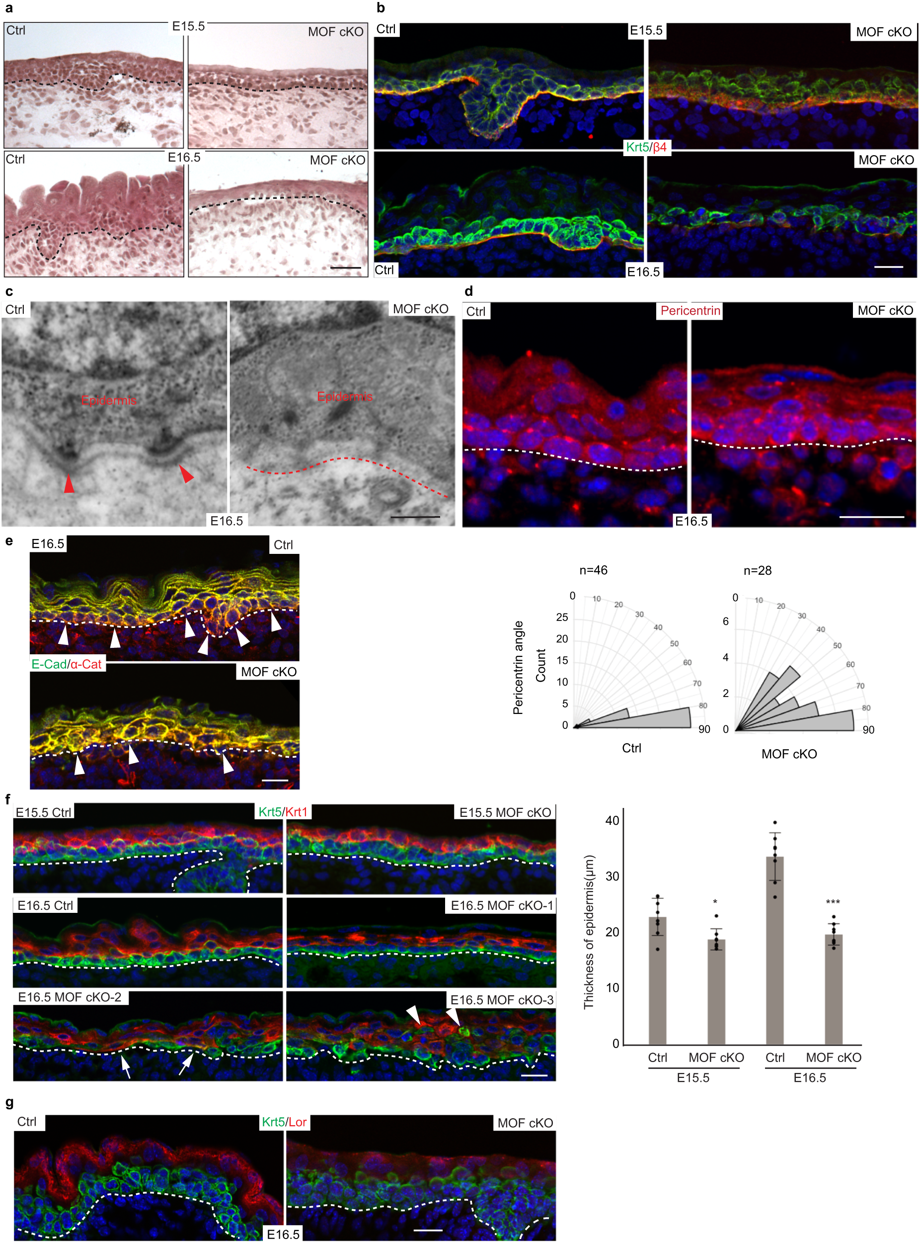 Fig. 2: Loss of MOF compromises basal cell adhesion, epidermal differentiation, and hair follicle morphogenesis.