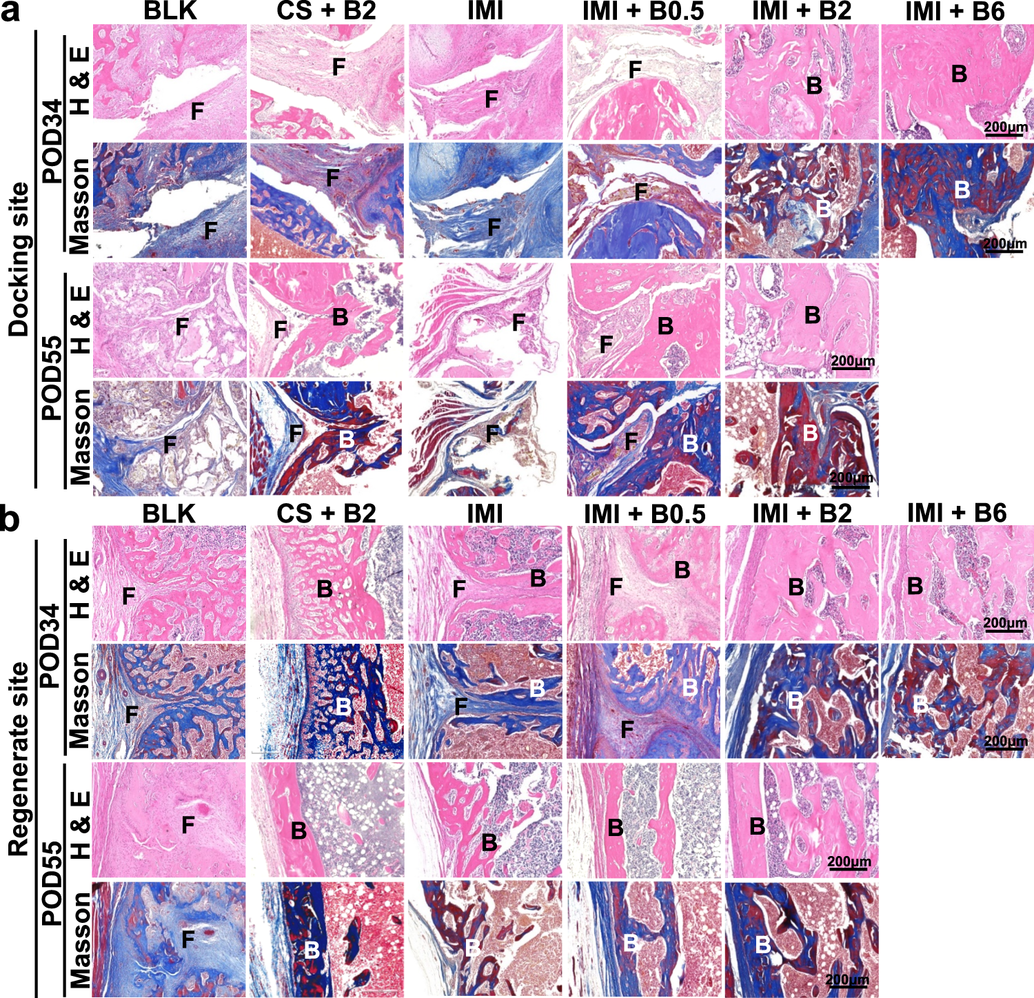 Fig. 4: Histology of bone regeneration at docking sites or regenerate sites in the femoral specimens on POD34 or POD55.