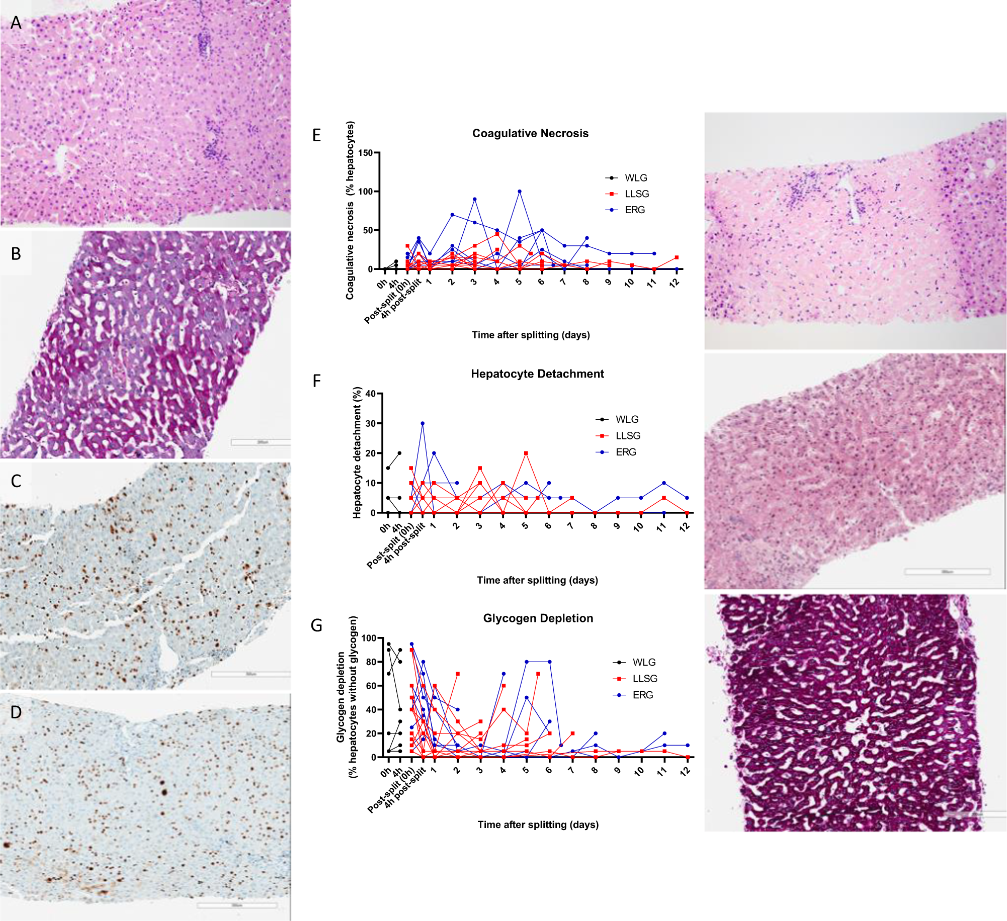 Fig. 3: Histopathology analysis of liver core biopsies taken throughout long-term perfusion of human split livers.