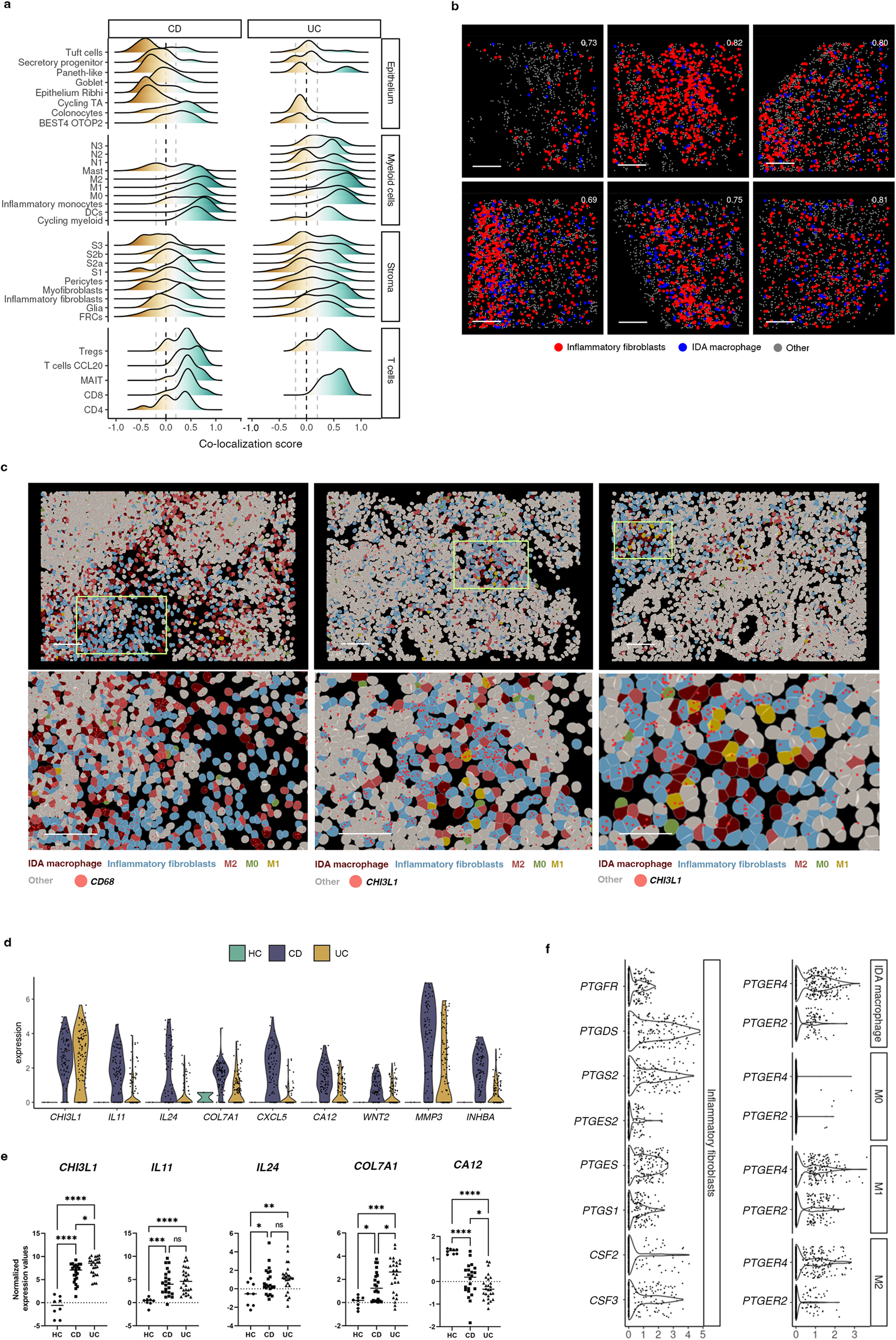Fig. 5: Inflammation-Dependent Associated (IDA) macrophages co-localize with inflammatory fibroblasts.