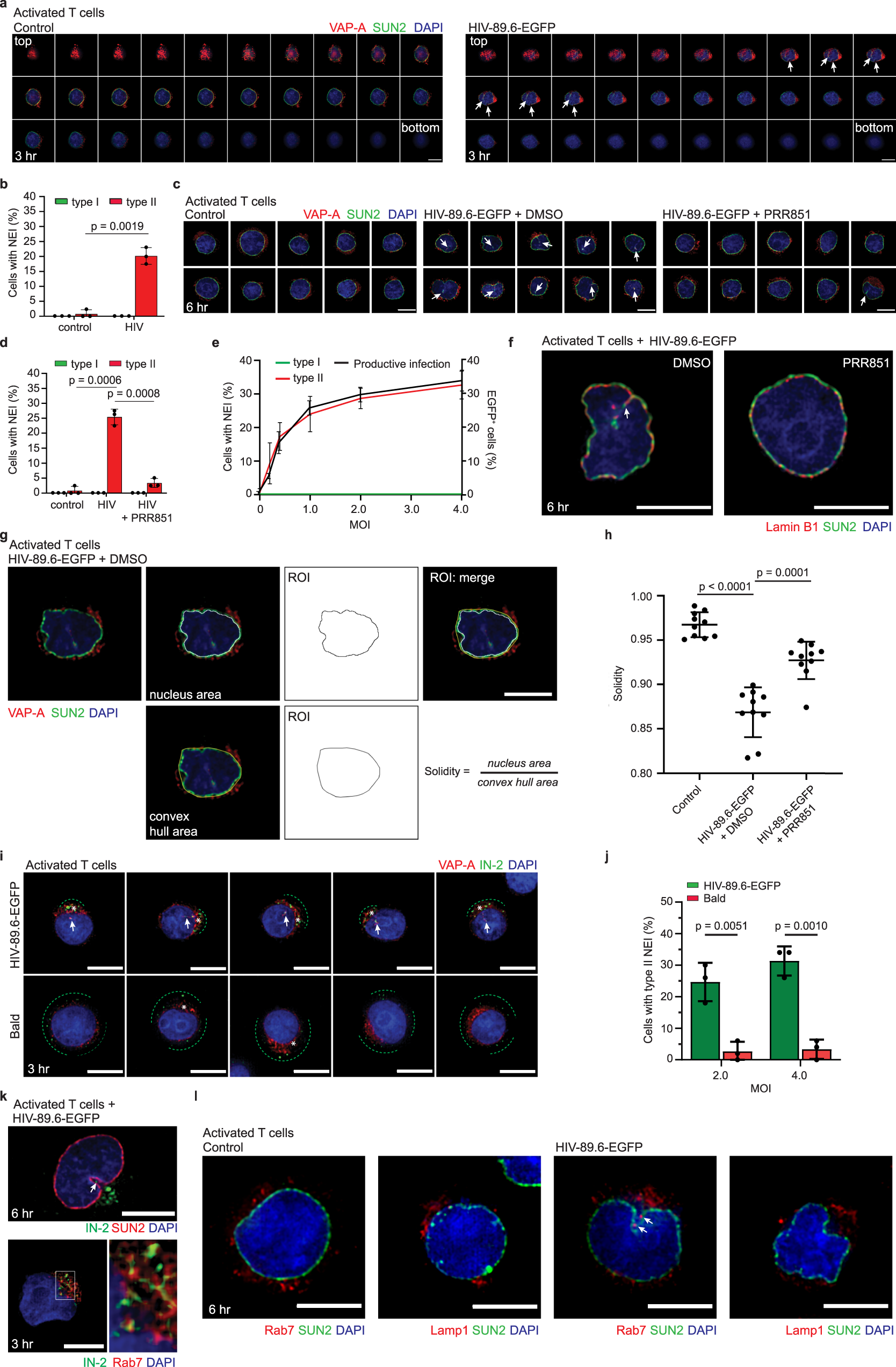 Fig. 6: Native Env-pseudotyped HIV-1 infection of CD4+ T cells triggers type II NEIs biogenesis.