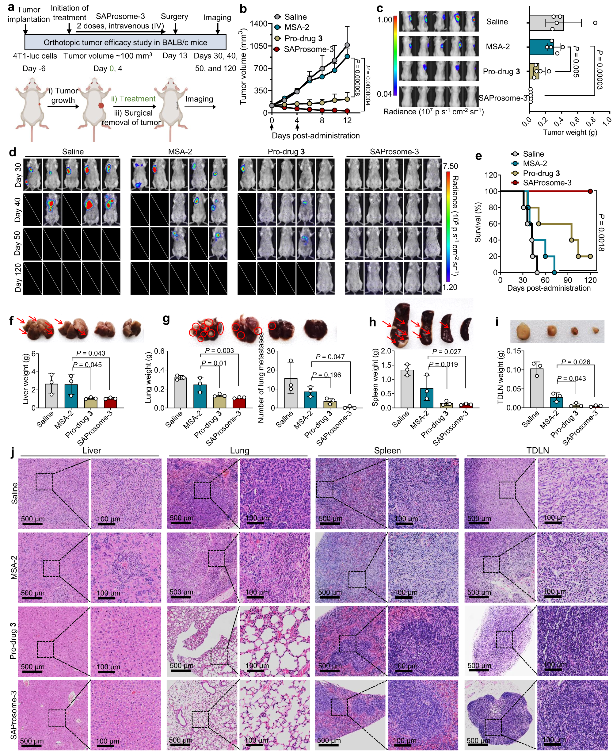 Fig. 5: SAProsome effectively inhibited tumor metastasis and recurrence after surgery.