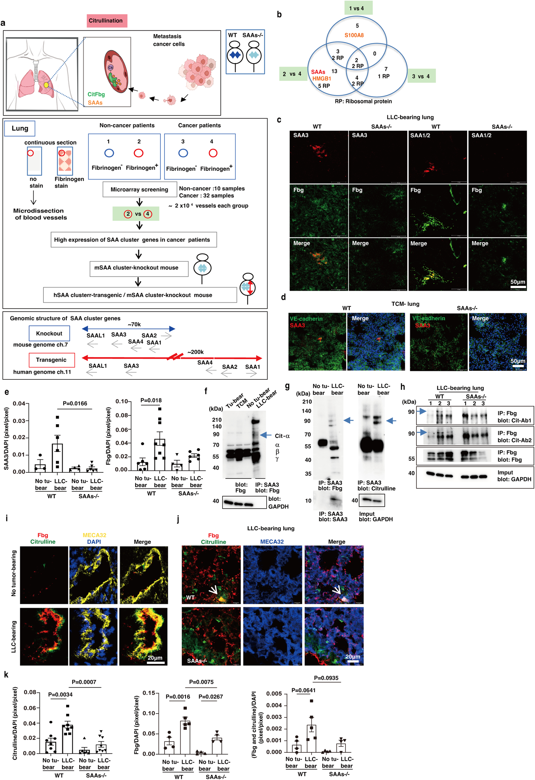 Citrullinated fibrinogen-SAAs complex causes vascular metastagenesis Nature Communications picture photo