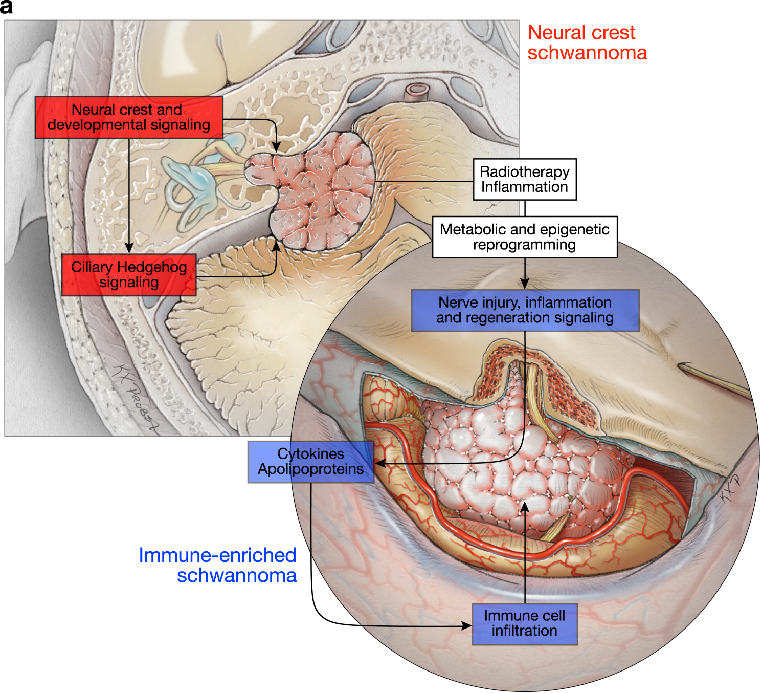 Fig. 5: An integrated model of schwannoma tumorigenesis and epigenetic reprogramming in response to treatment.