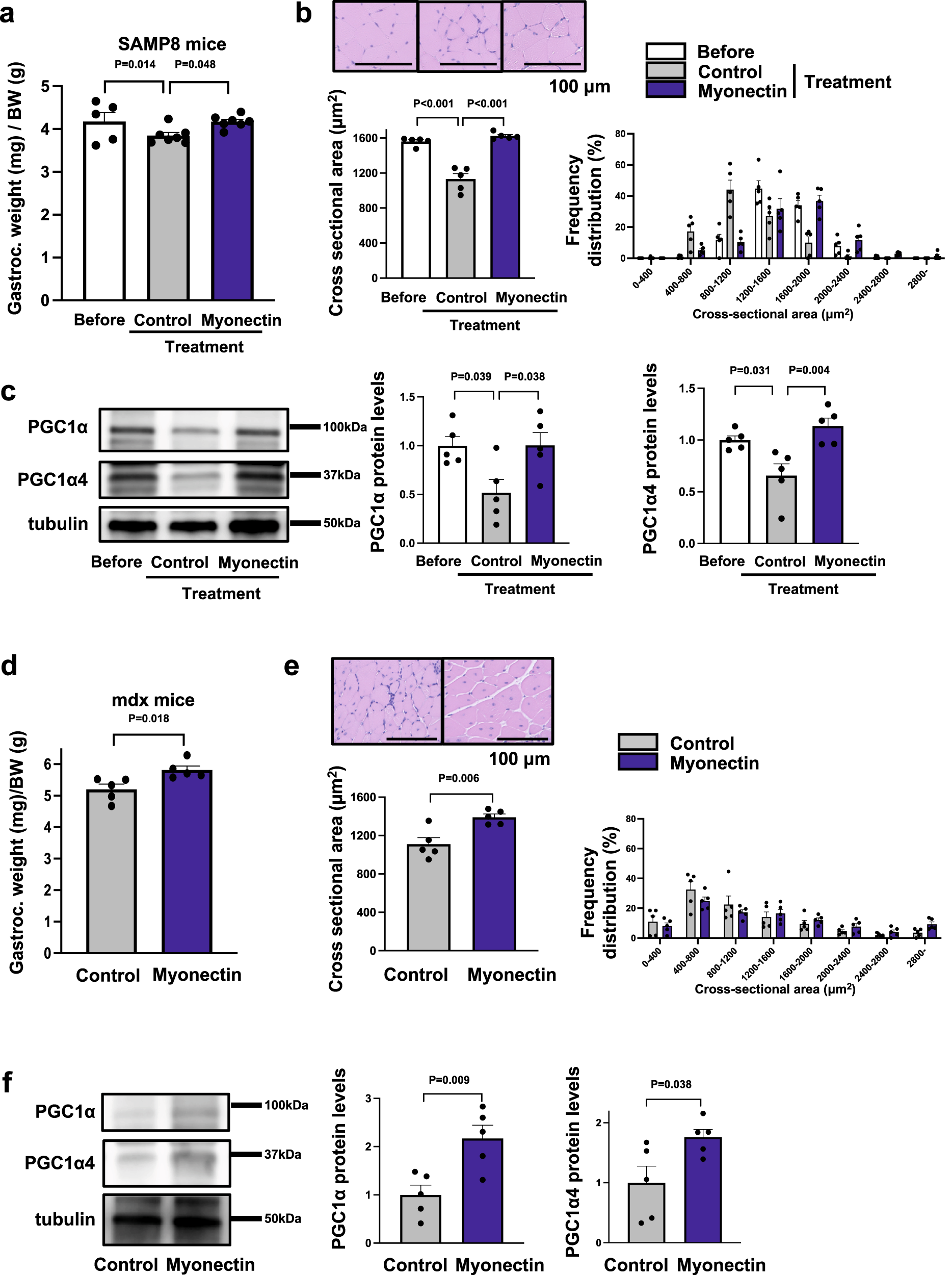Fig. 7: Myonectin administration improves muscle atrophy in SAMP8 and Mdx mice.