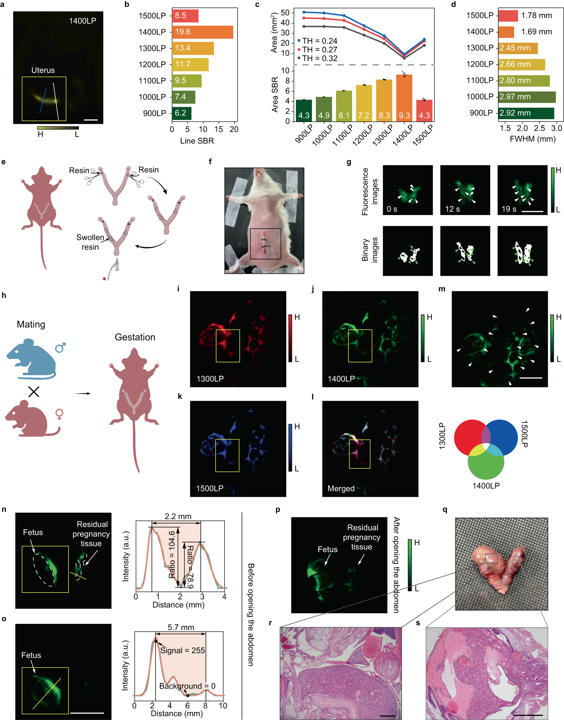 Fig. 5: The precise detection of intrauterine foreign body in vivo.
