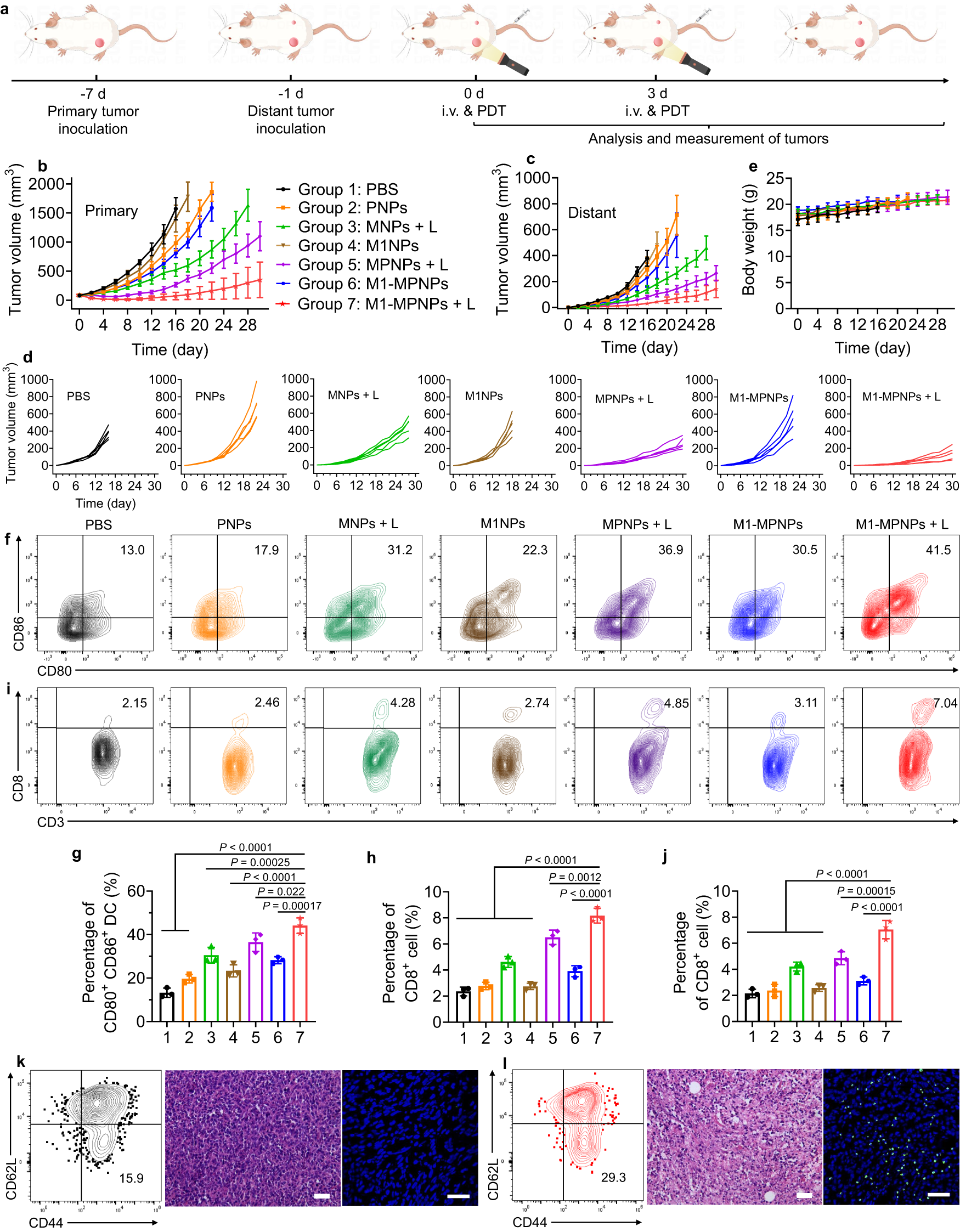 Fig. 8: M1-MPNPs for suppressing primary tumor and distant tumor recurrence.