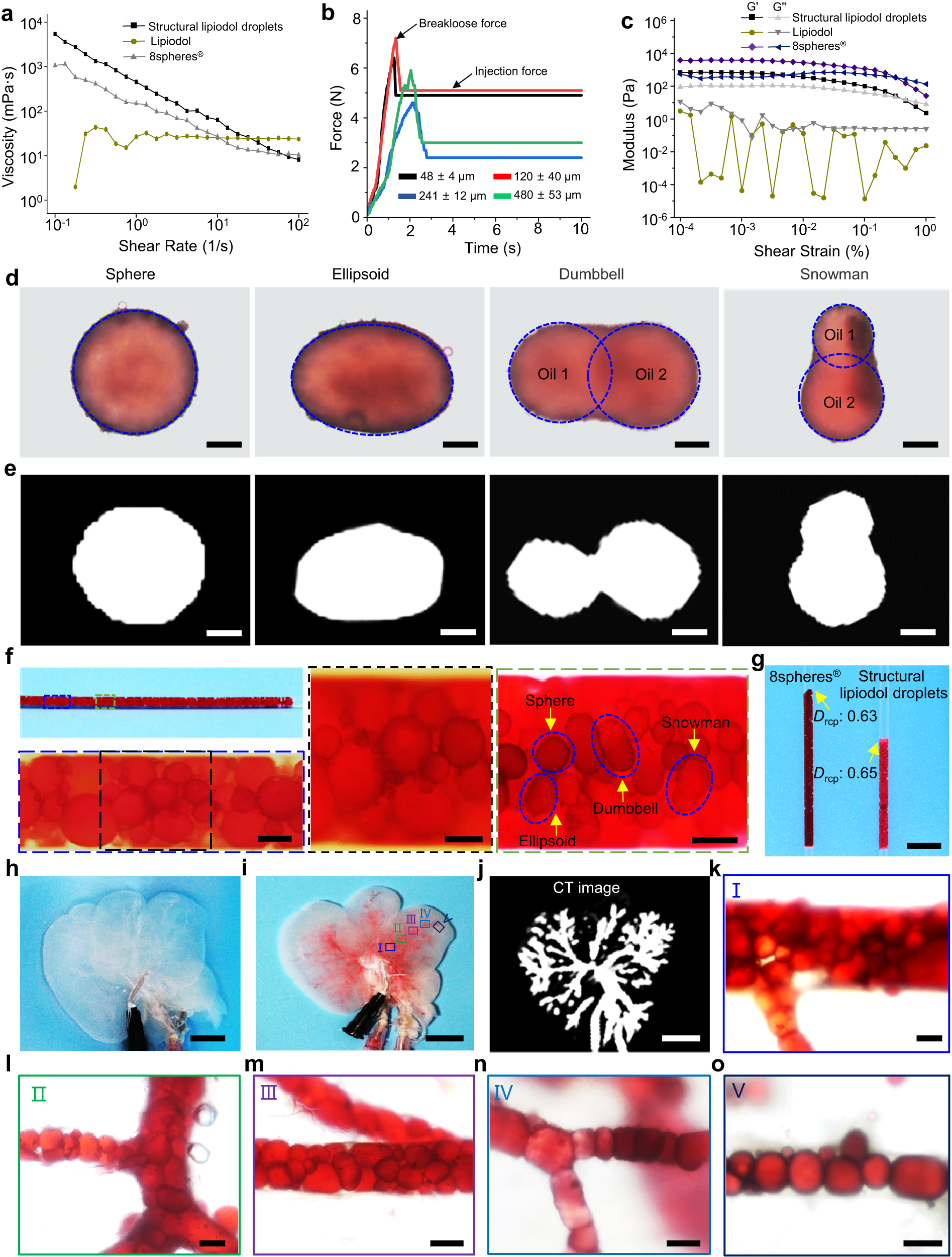 Fig. 3: Viscoelasticity and embolization effectiveness of Janus particle-engineered structural lipiodol droplets in vitro.
