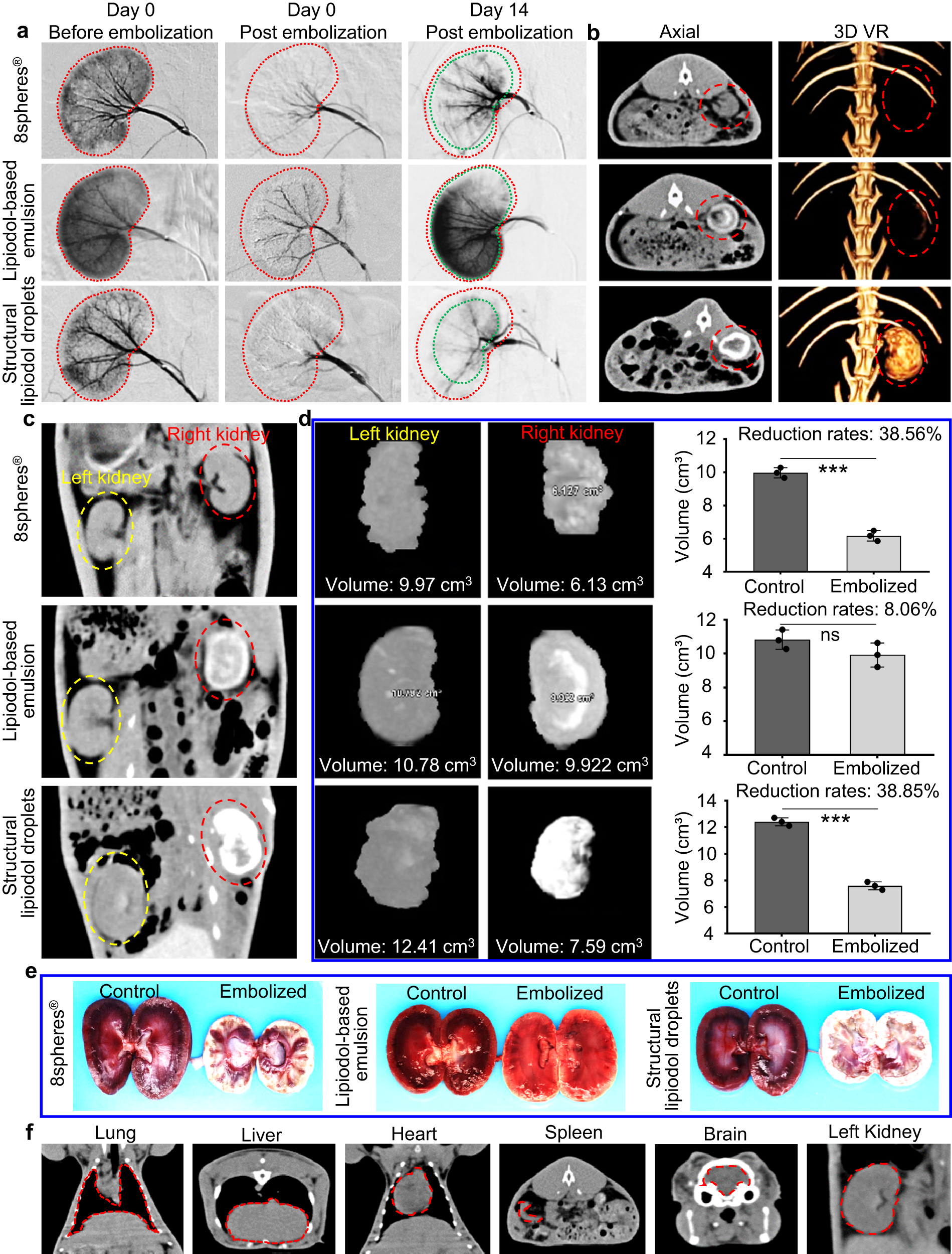 Fig. 4: Embolization effectiveness of Janus particle-engineered structural lipiodol droplets in the kidneys of rabbits.