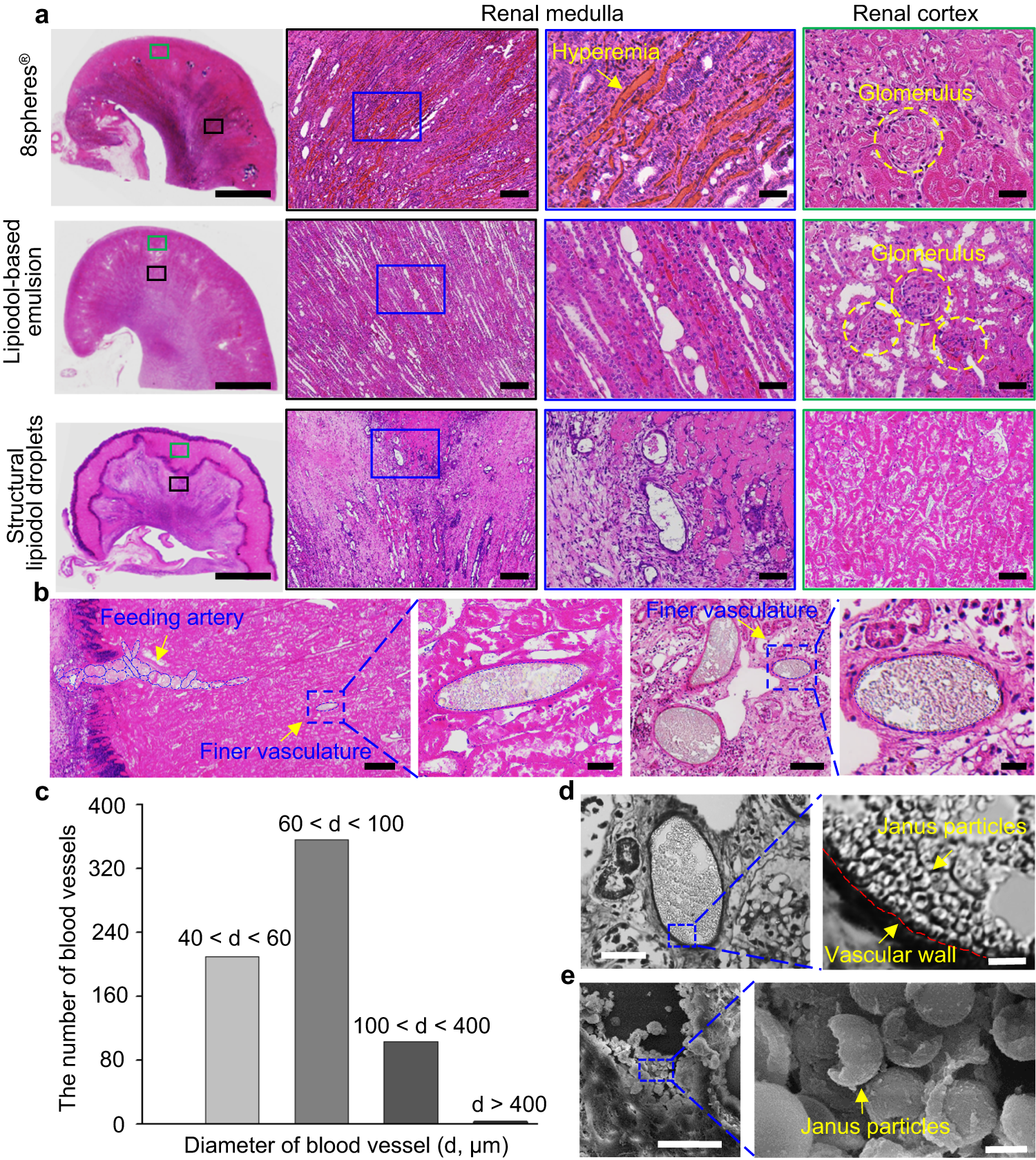 Fig. 5: Pathological analysis of the embolization effectiveness of Janus particle-engineered structural lipiodol droplets, lipiodol-based emulsion, and 8spheres® beads after 14 days post-embolization.