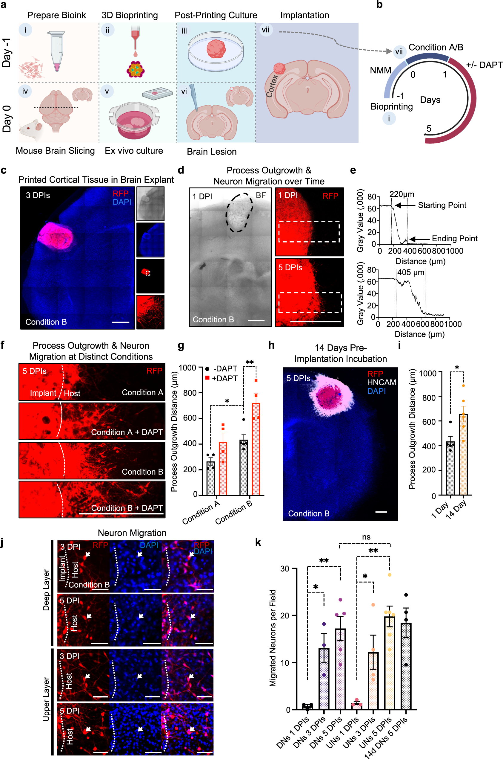 Fig. 4: Implantation of printed single-layer cortical tissue into brain explants.