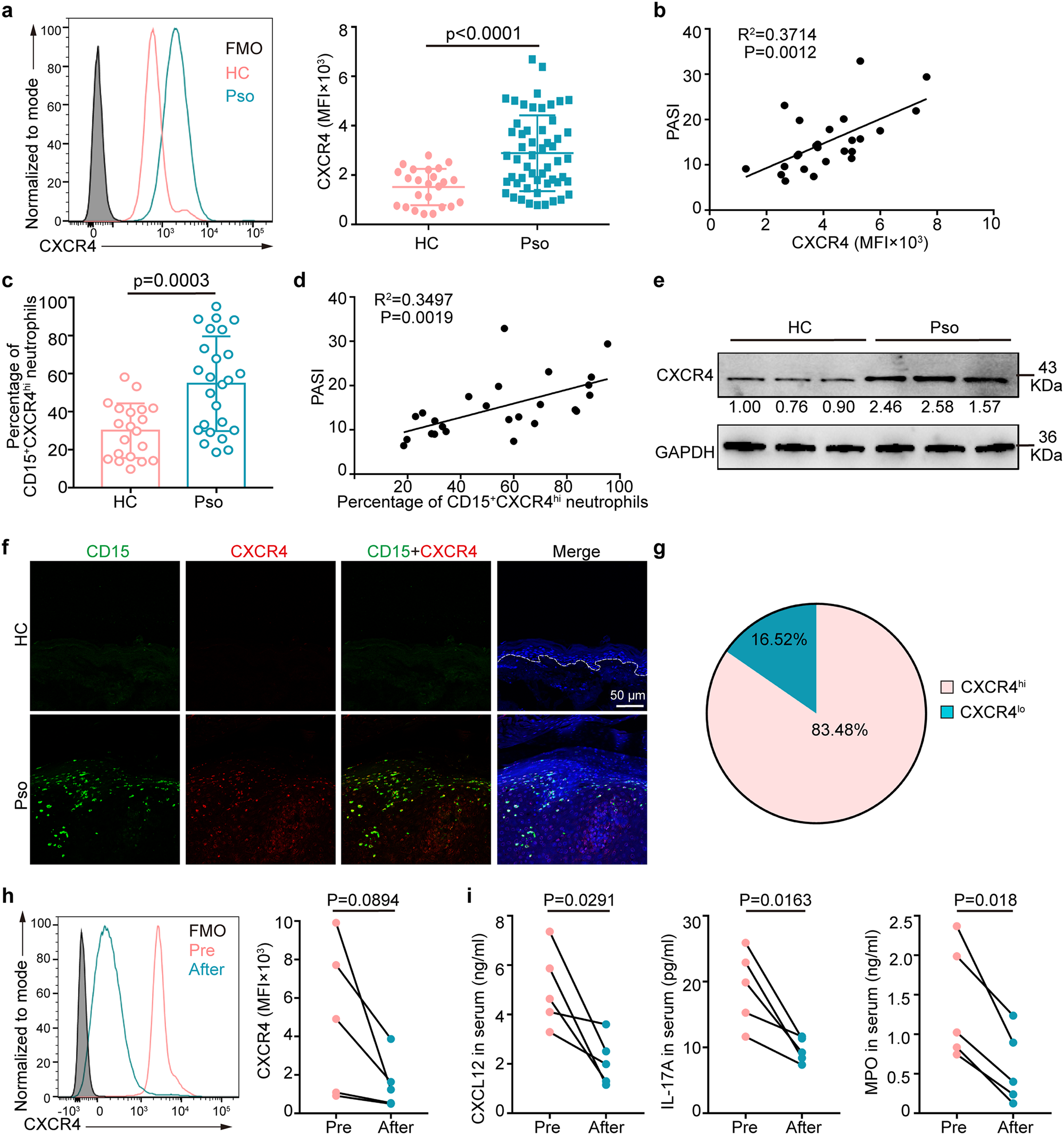 Post hoc test results of mean TGF-β1 secretion in gingival crevicular