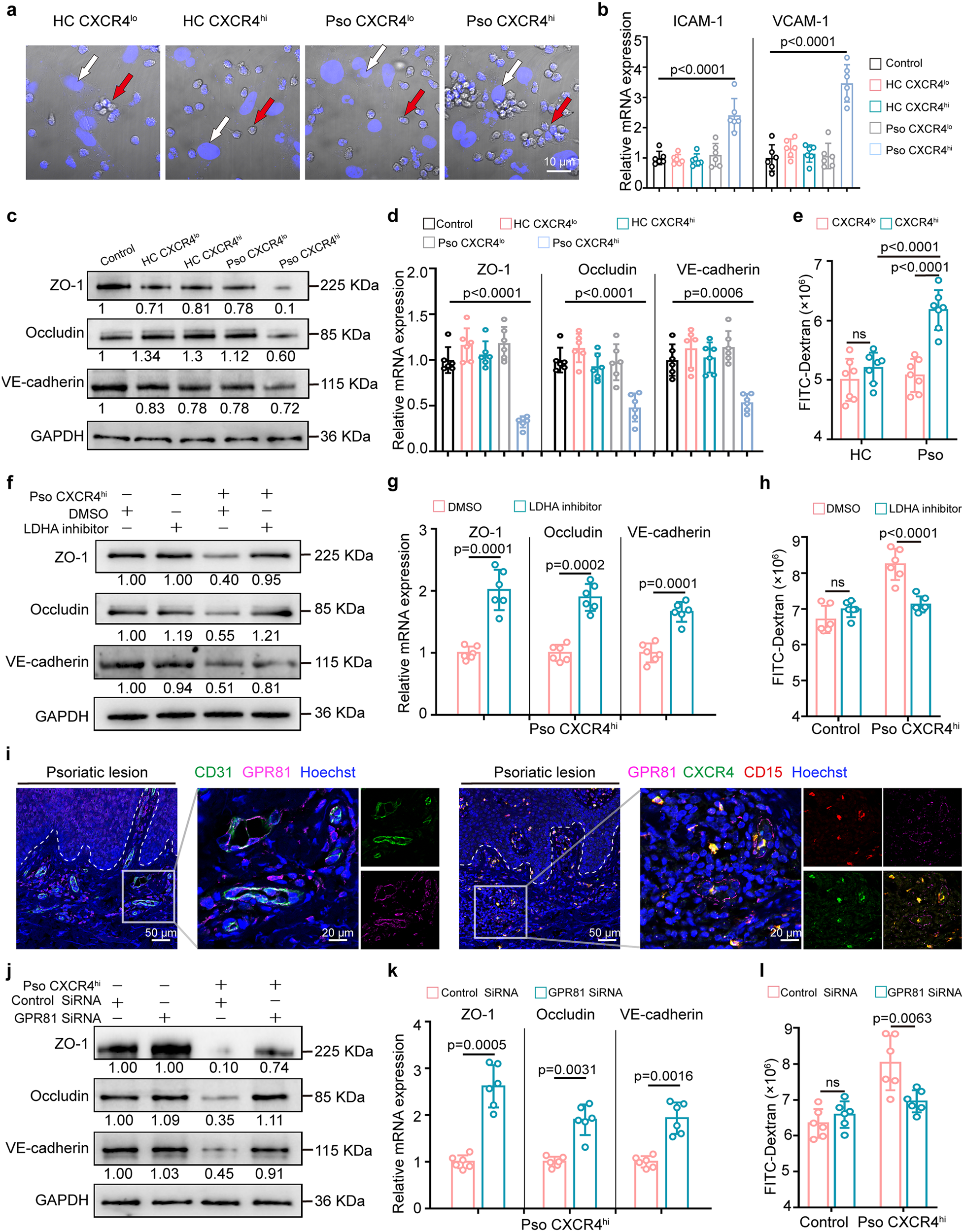 Fig. 4: Lactate released by CXCR4hi neutrophils induces vascular remodeling and permeability.