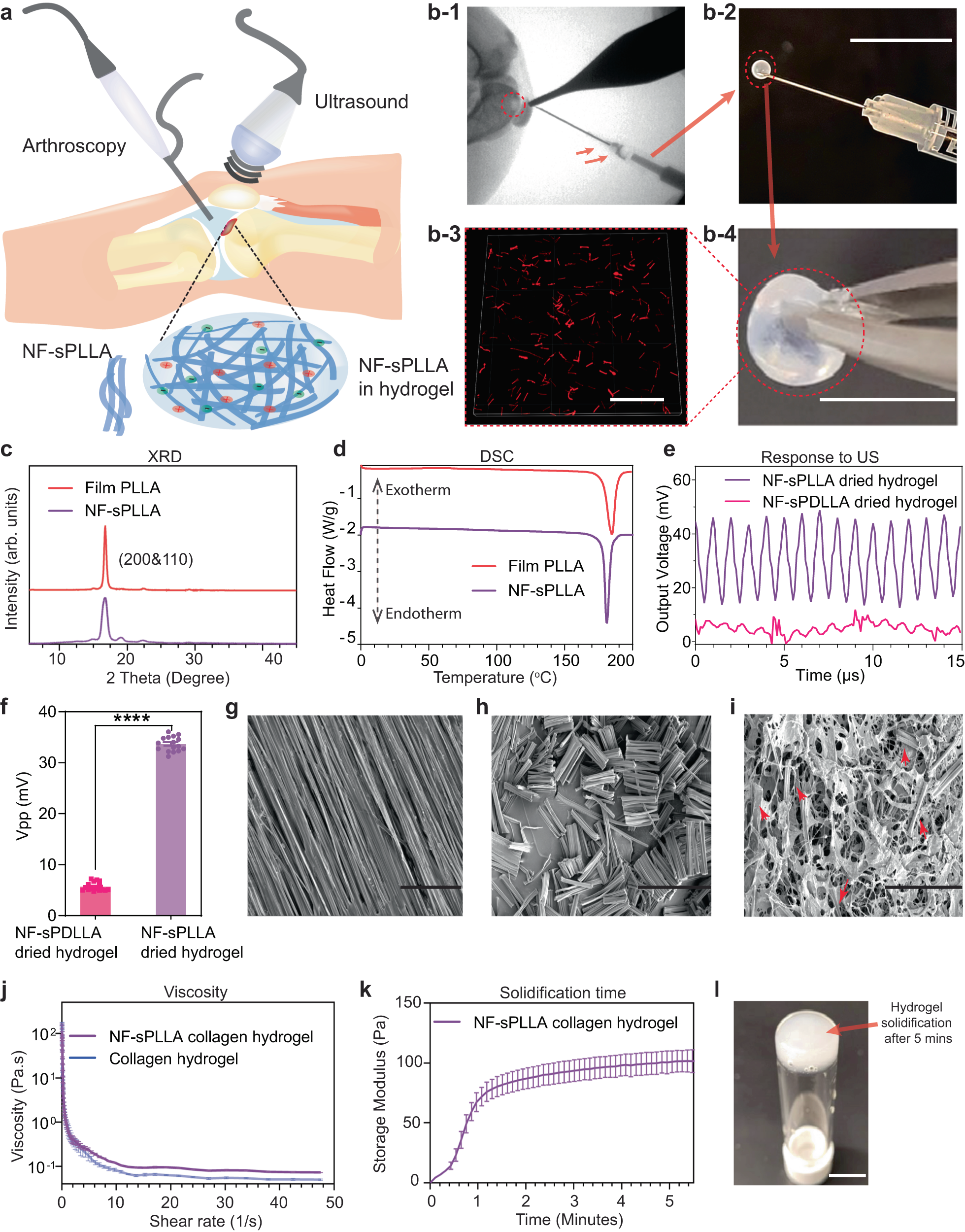 Injectable and biodegradable piezoelectric hydrogel for osteoarthritis  treatment | Nature Communications
