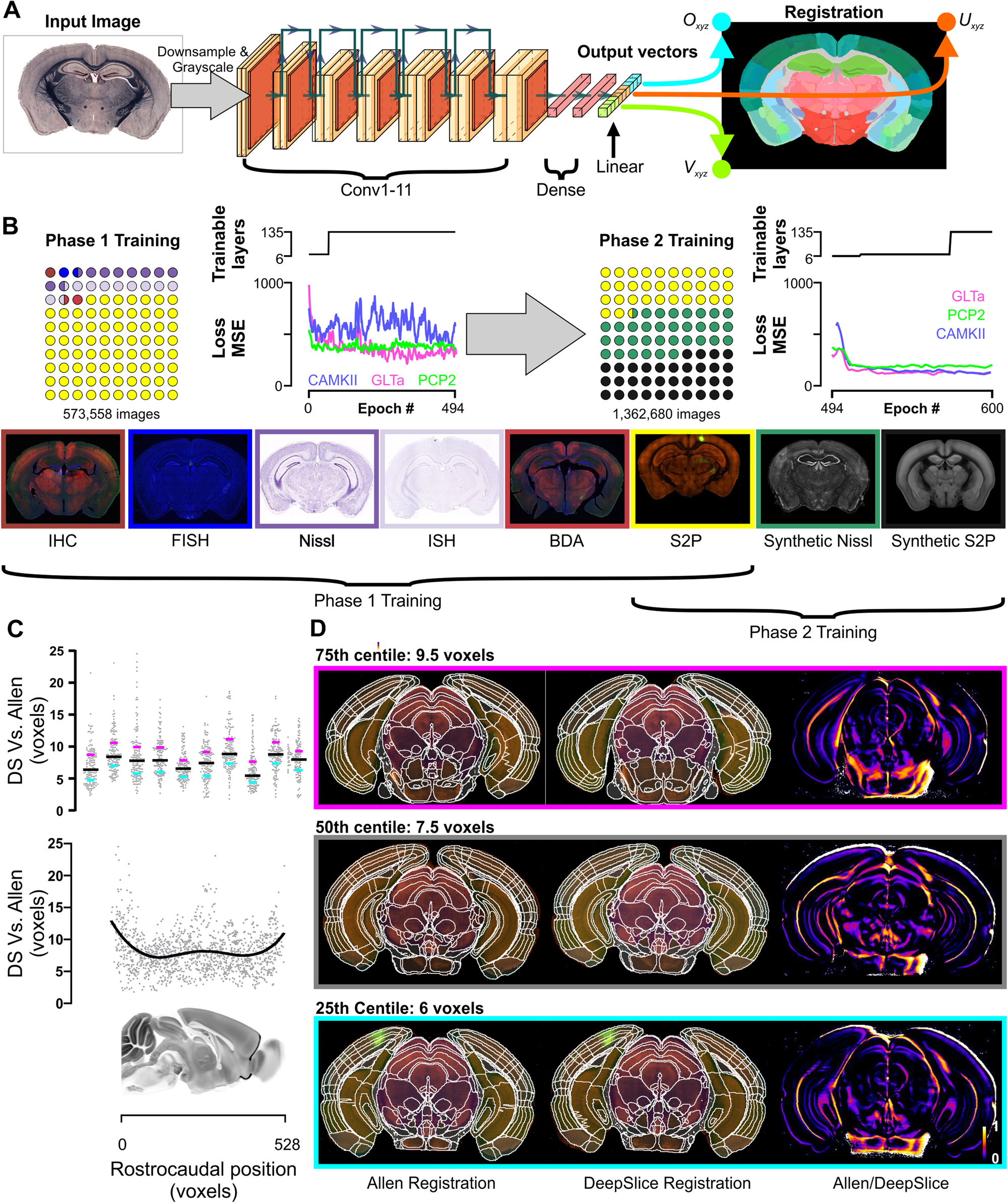 DeepSlice: rapid fully automatic registration of mouse brain imaging to a  volumetric atlas