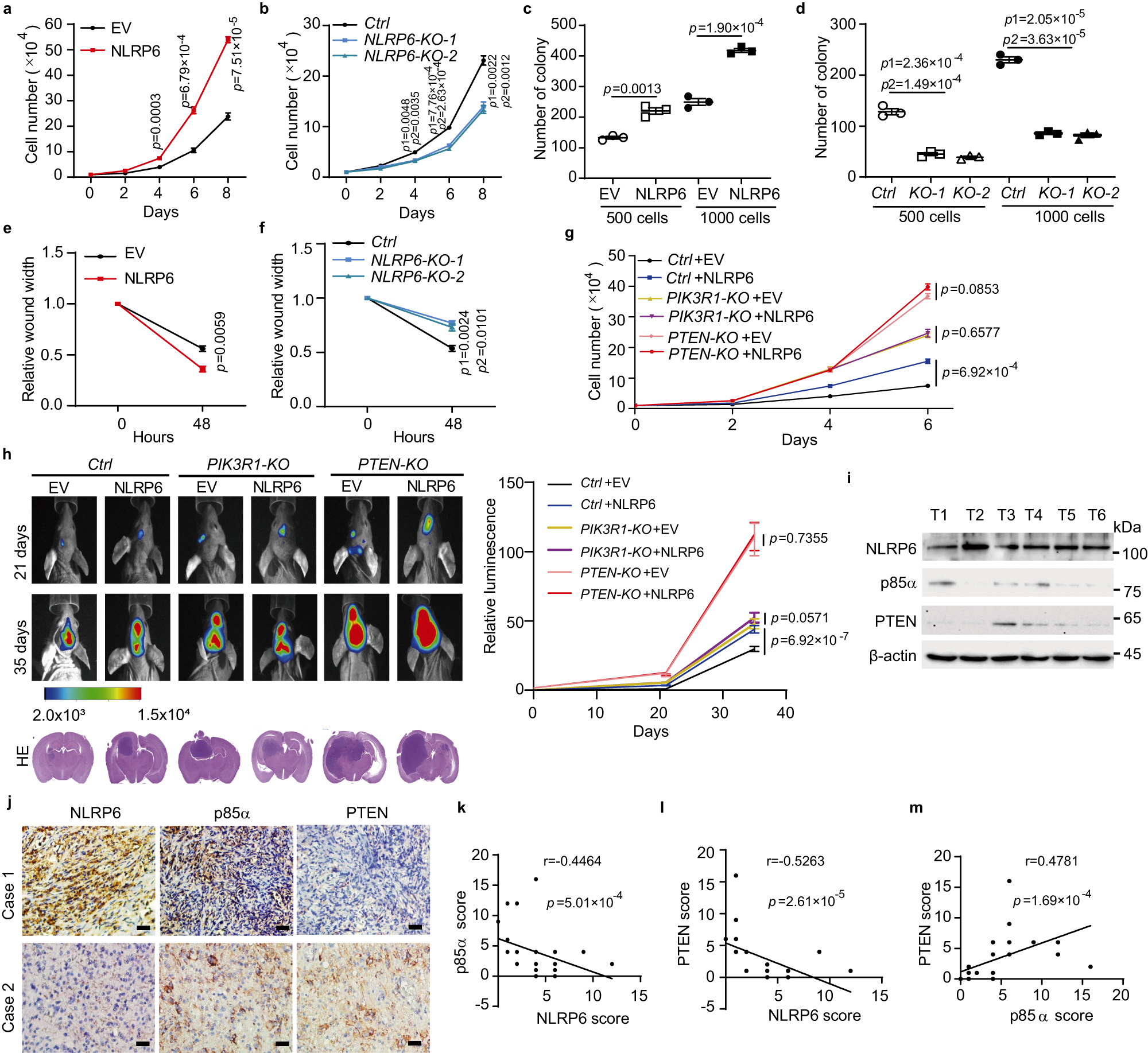 Fig. 5: NLRP6 promotes glioma tumorigenesis.