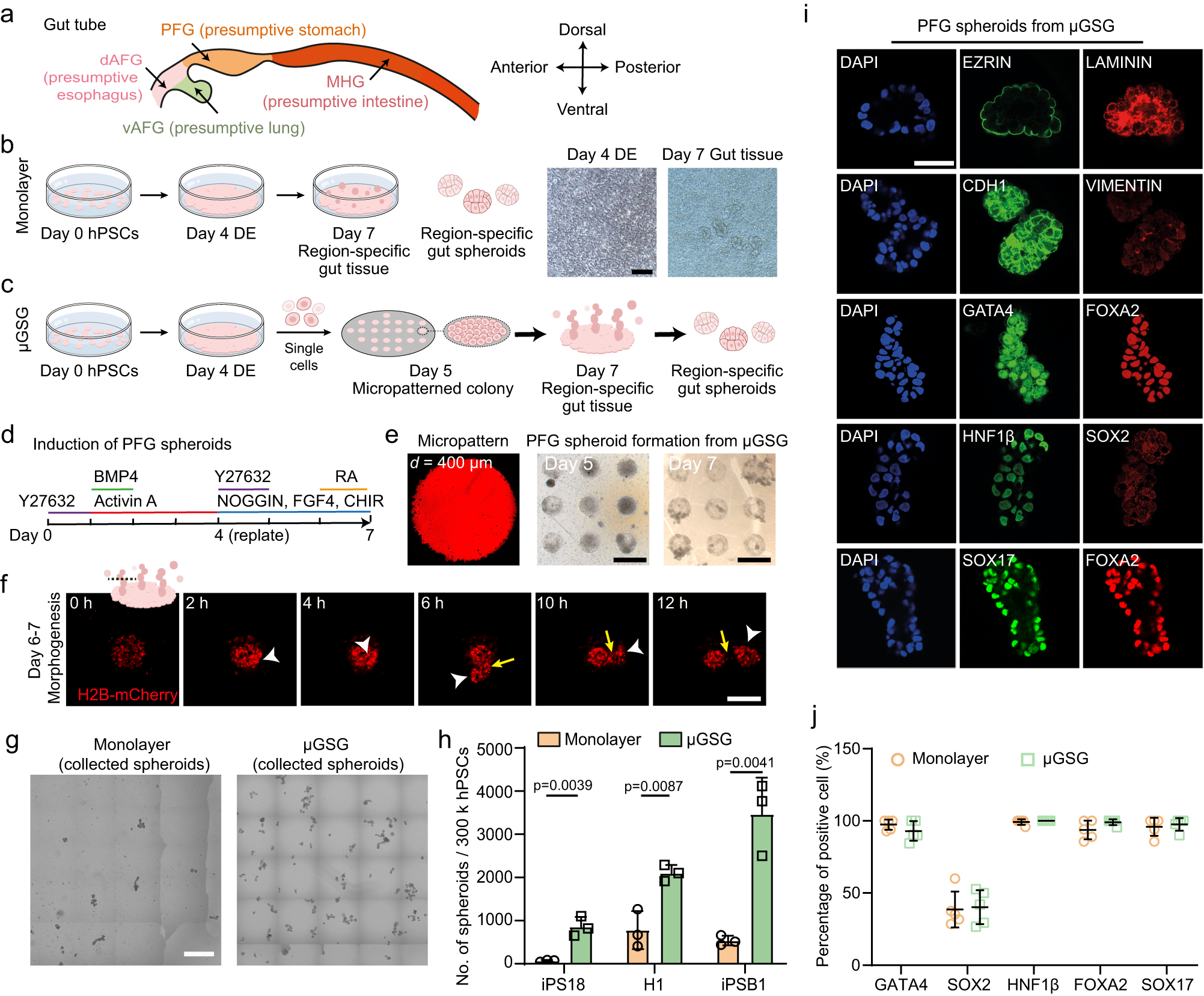 Actuation enhances patterning in human neural tube organoids