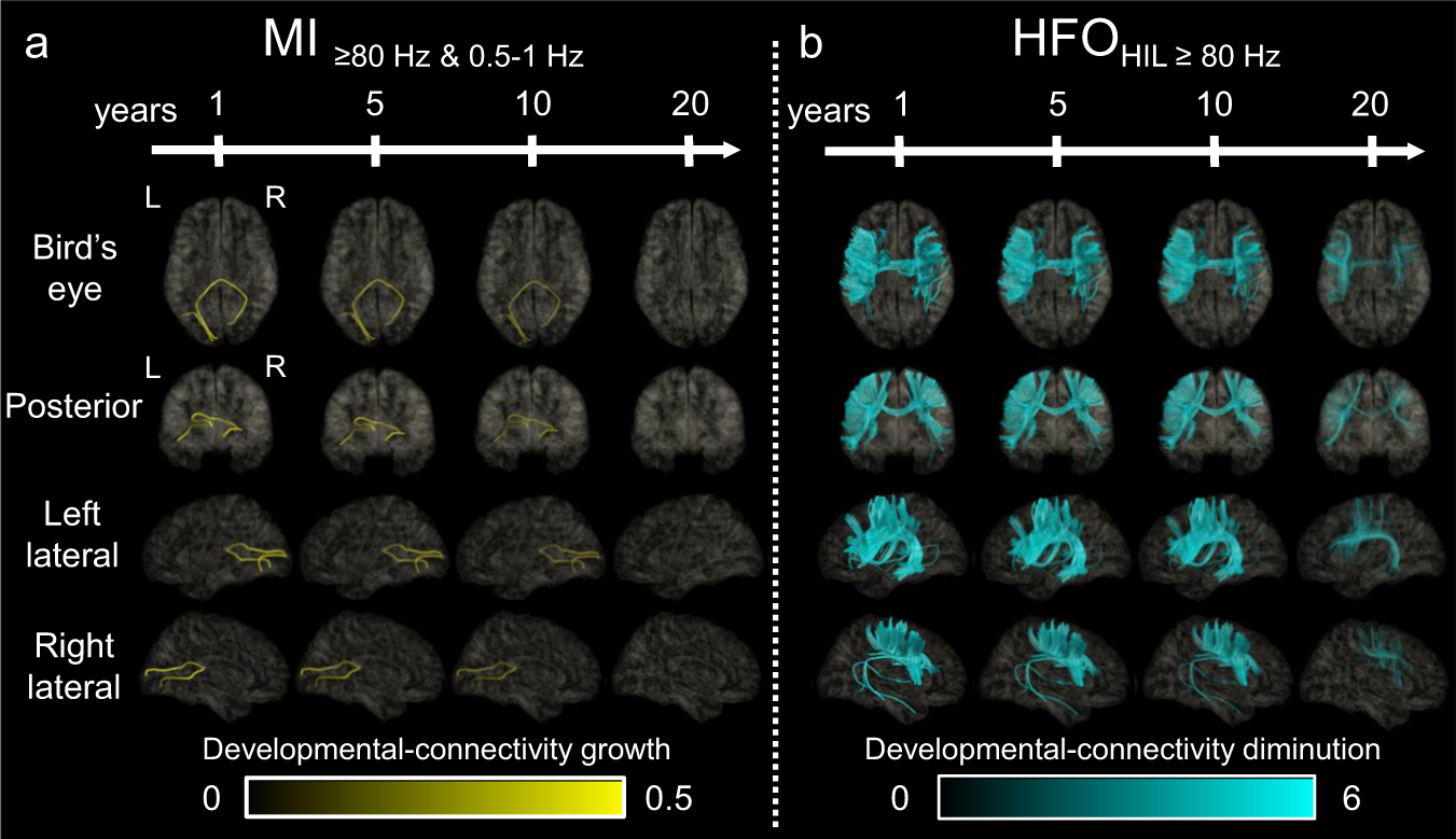 Fig. 5: Dynamic tractography.