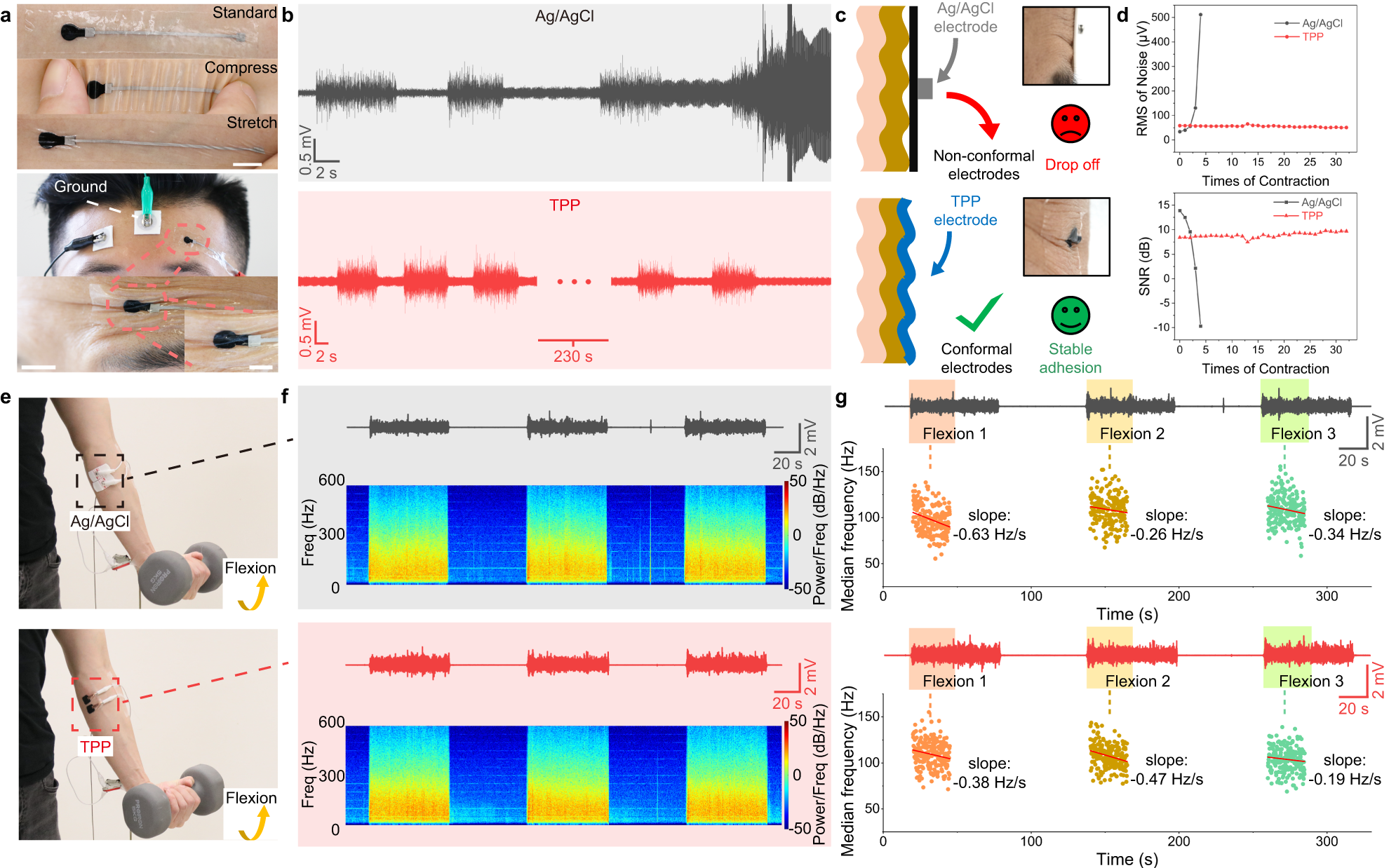 Fig. 4: Comparison of recording performances on skin between Ag/AgCl and TPP electrodes.