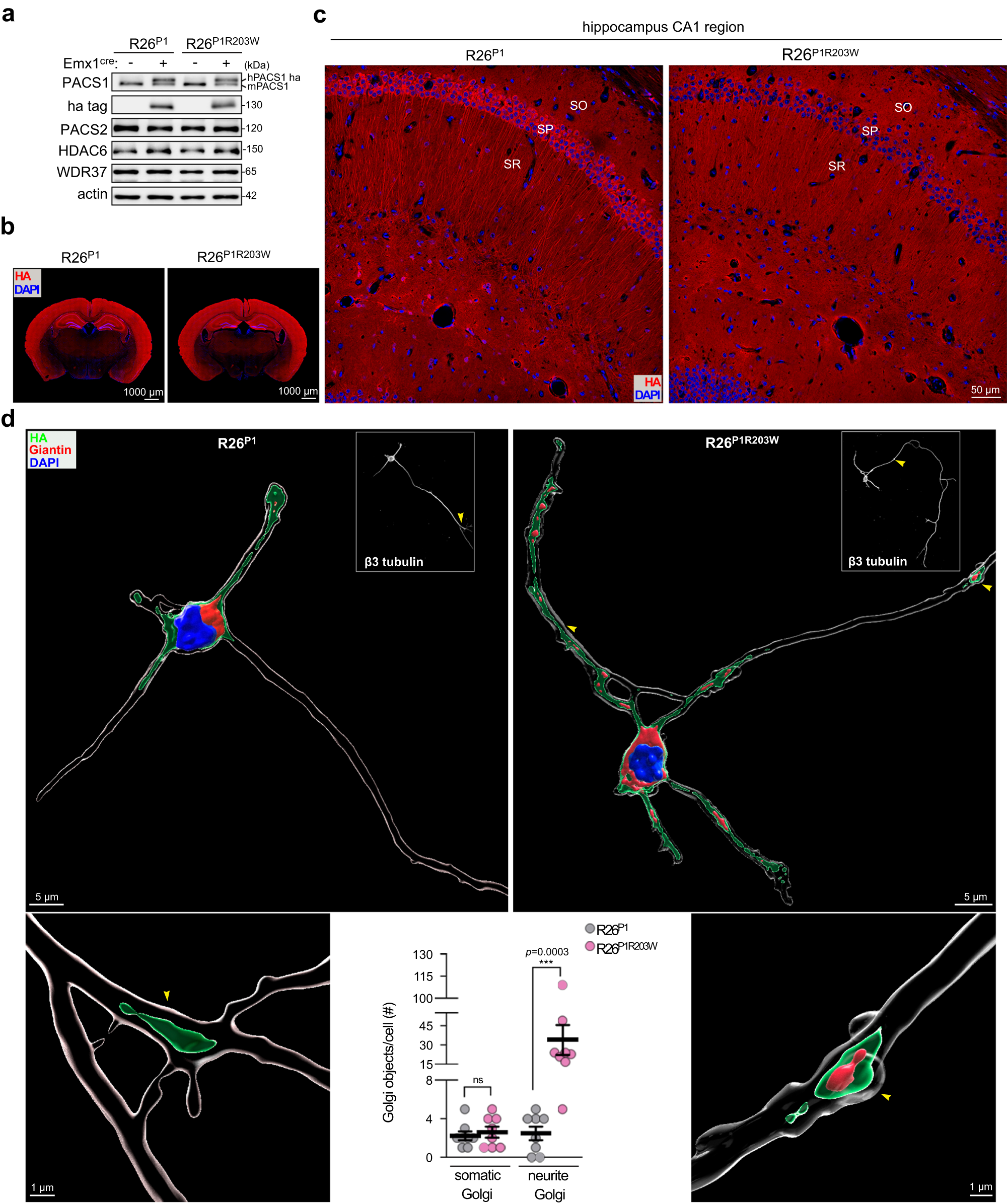 Fig. 3: PACS1R203W causes Golgi outposts to deploy into dendrites of hippocampal neurons.