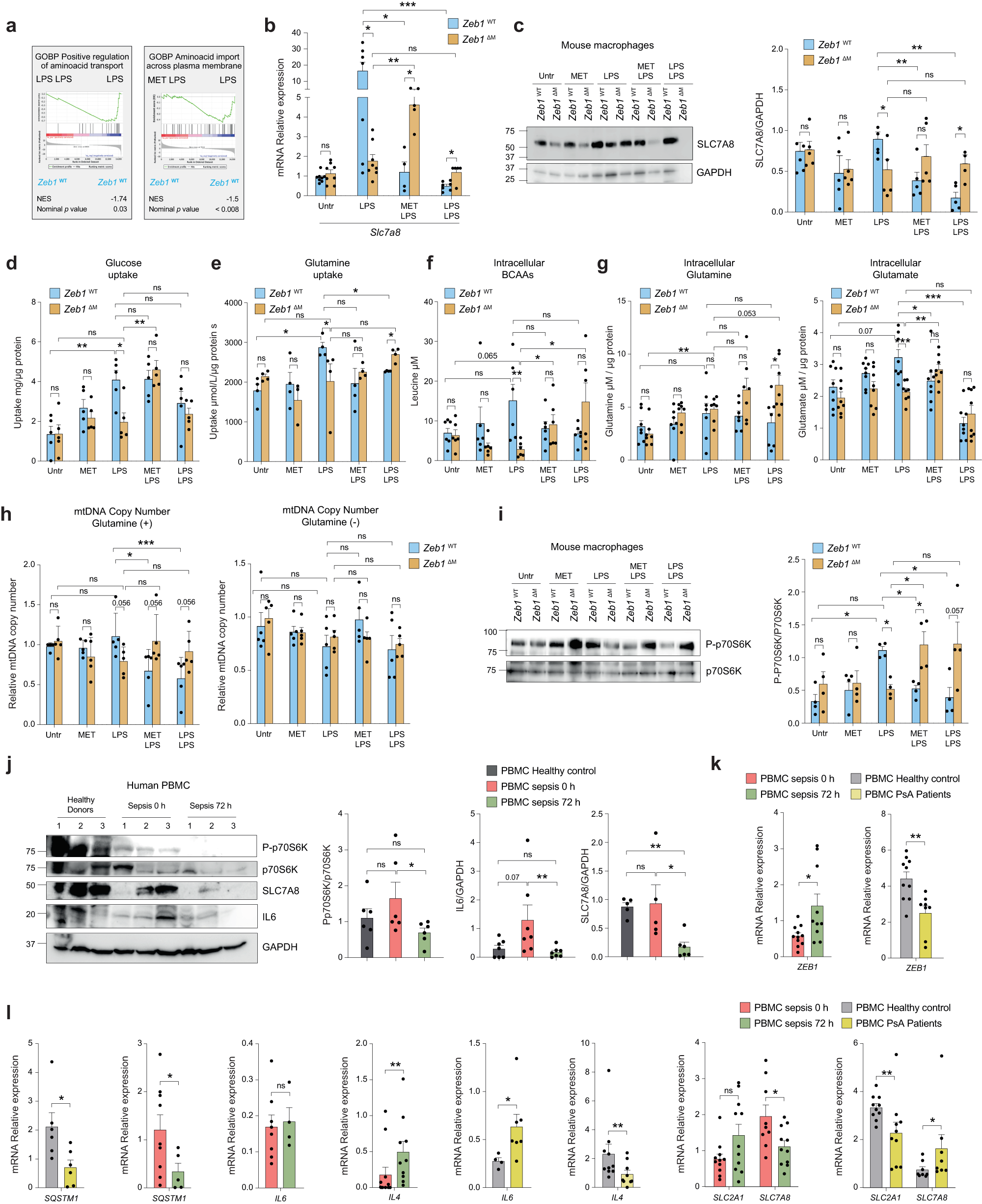 Fig. 6: ZEB1 inhibits mitochondrial protein translation by restricting amino acid transport.
