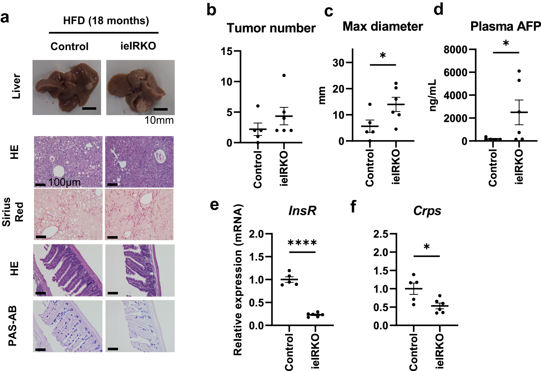 Fig. 9: Phenotypes of continuous high-fat-diet-fed ieIRKO mice at 18 months of age.
