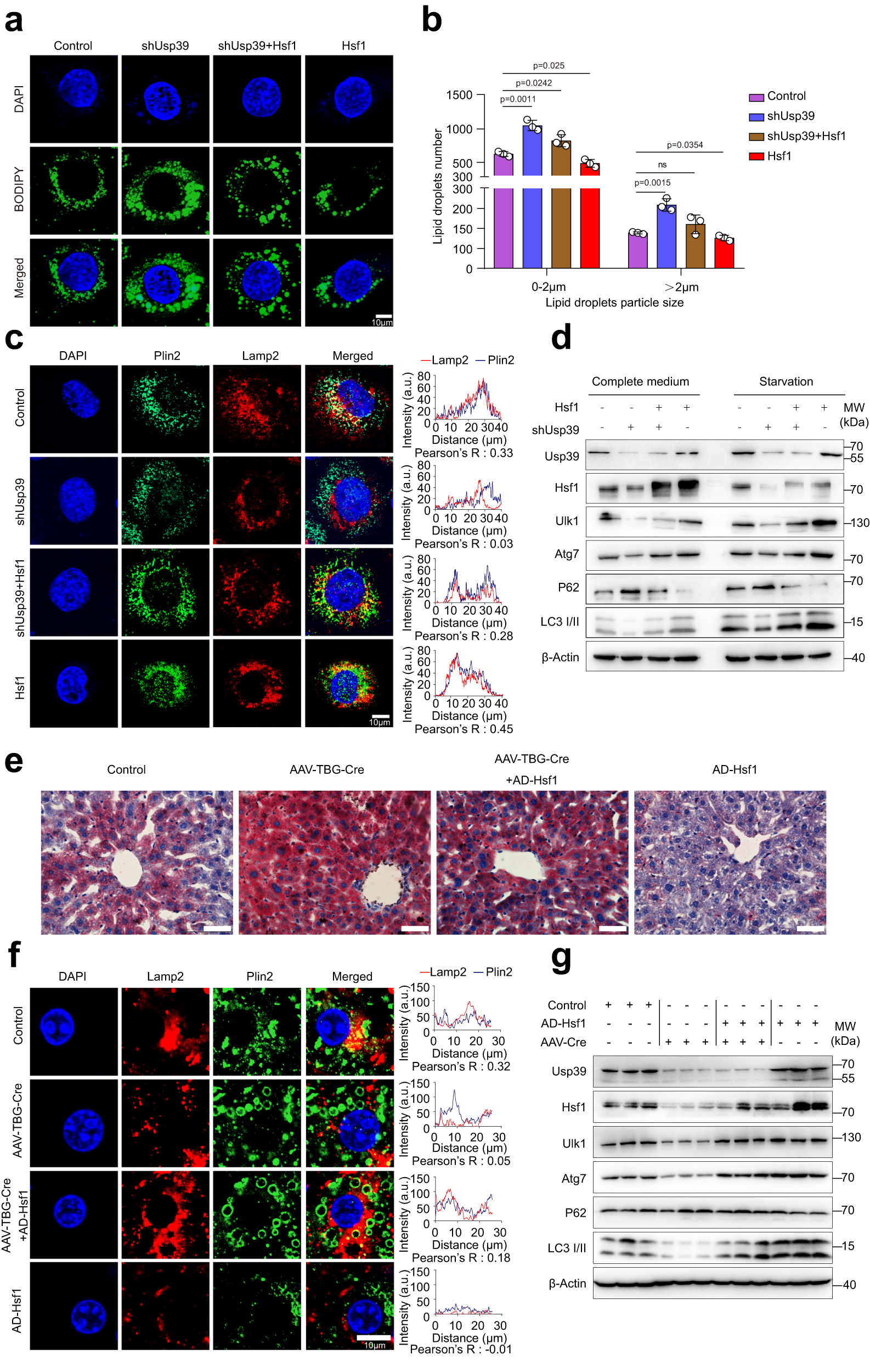 Fig. 7: Hsf1 promotes autophagy and alleviates hepatic steatosis caused by Usp39 deletion.