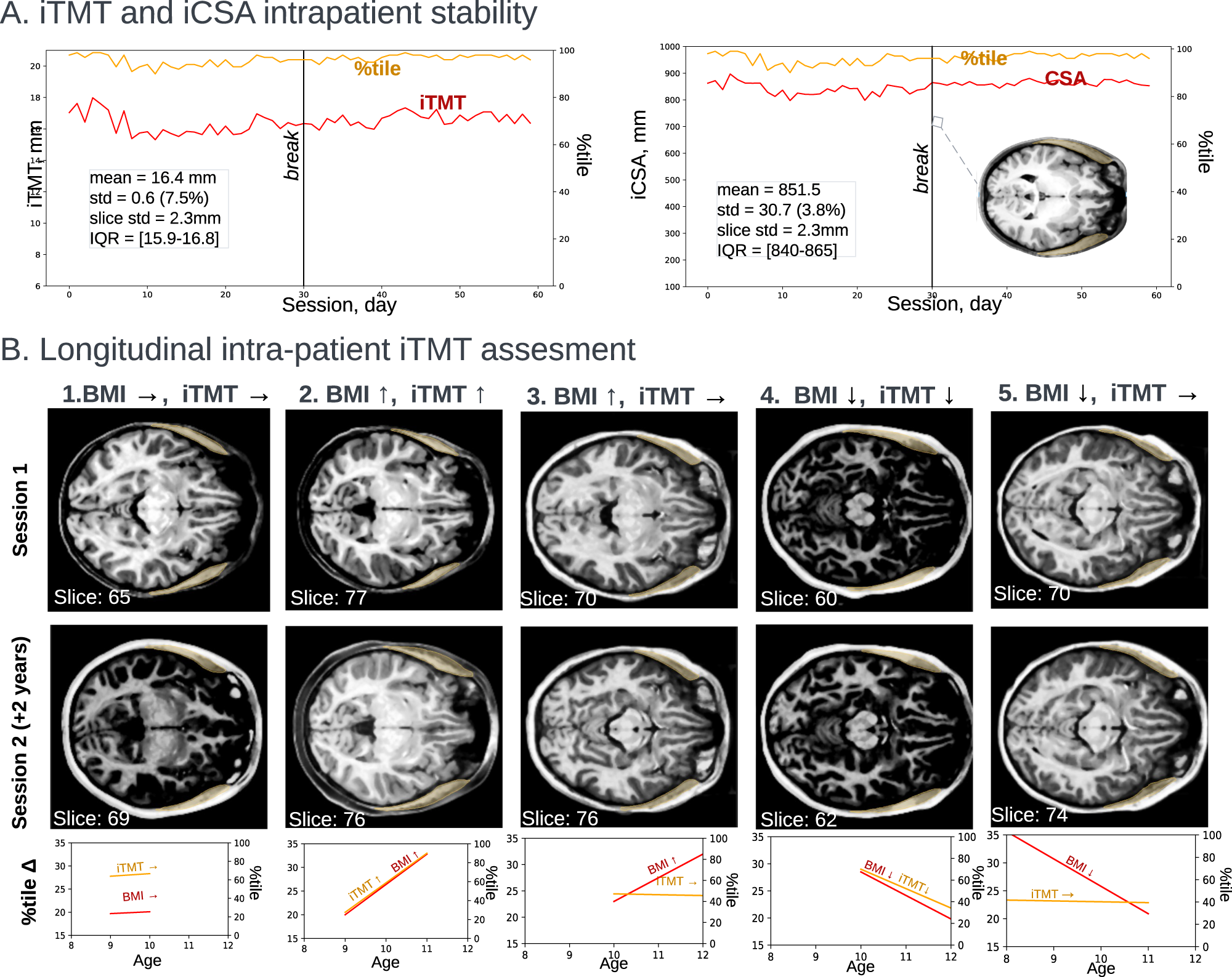 Fig. 6: Longitudinal intra-patient iTMT assessment.