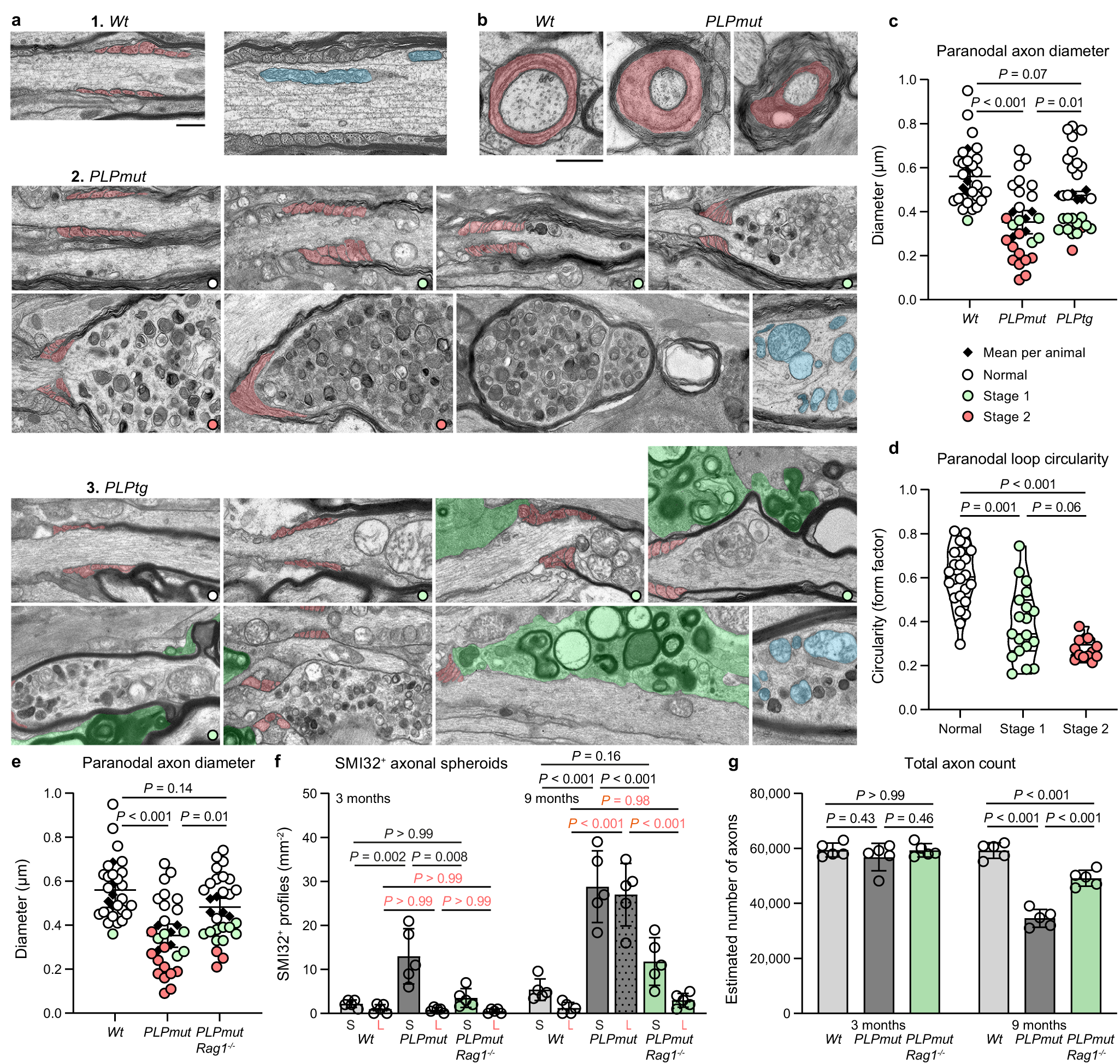 Fig. 6: T cell-driven axonal spheroid formation is initiated in proximity to constricted paranodal domains.