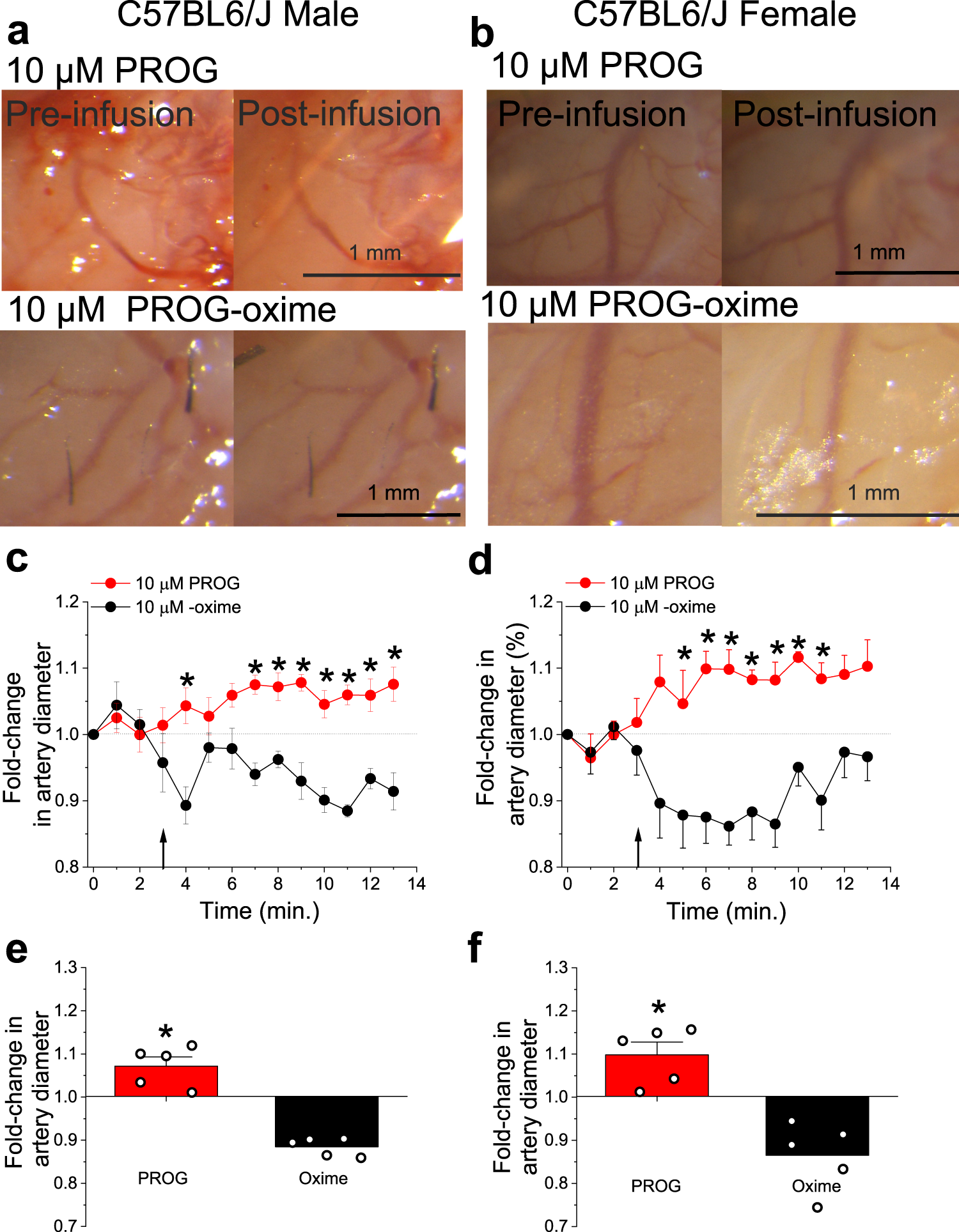 Fig. 7: Through β1-involvement, progesterone similarly dilates cerebral arteries of male and female mice when evaluated in vivo.