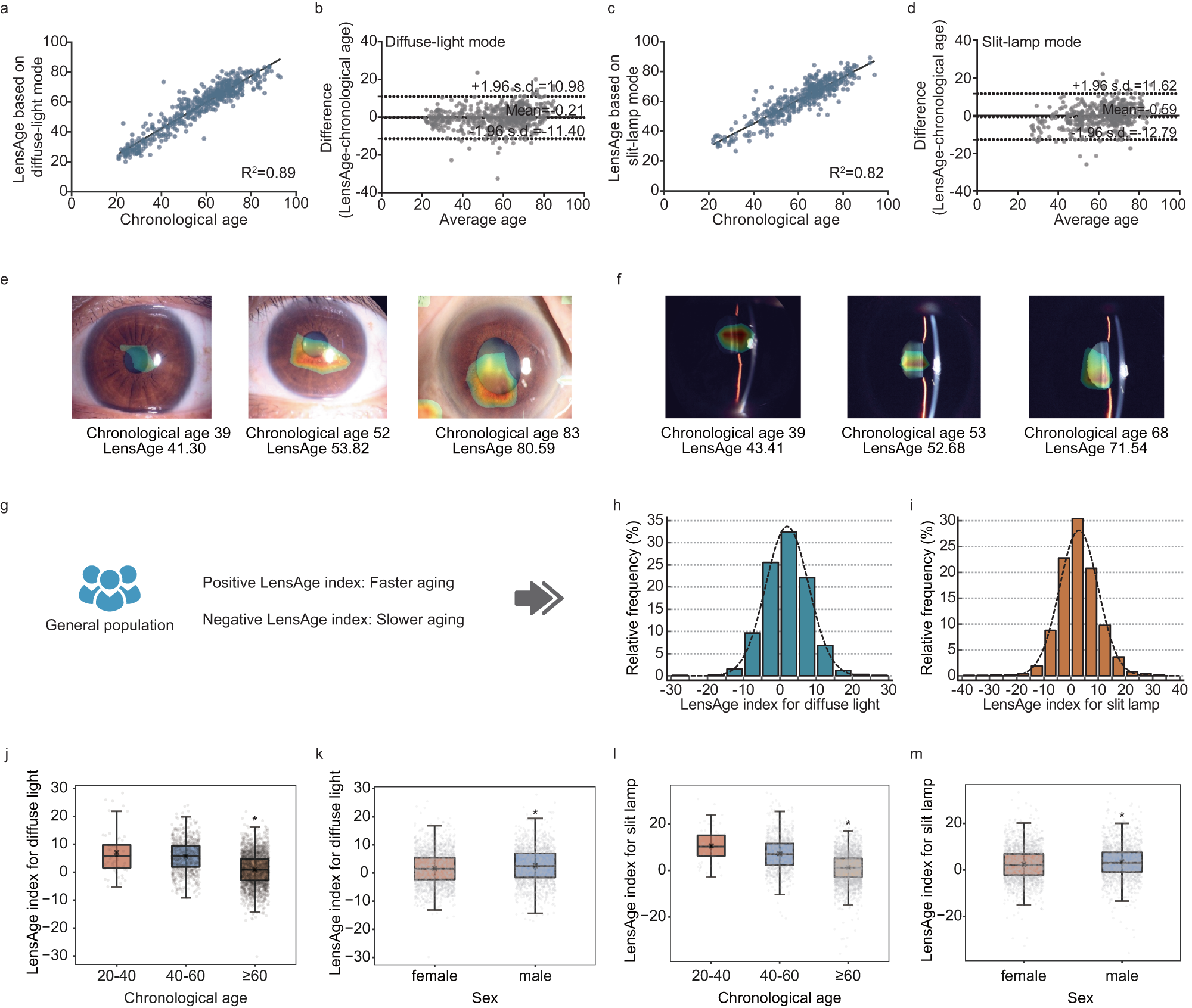 Fig. 2: Analyses of LensAge and the LensAge index based on InceptionV3 models.