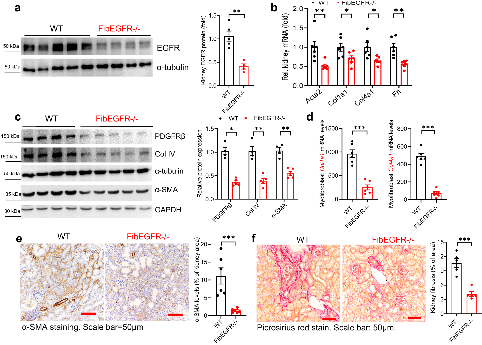 Fig. 5: Mice with selective fibroblast EGFR deletion developed less fibrosis after UUO.