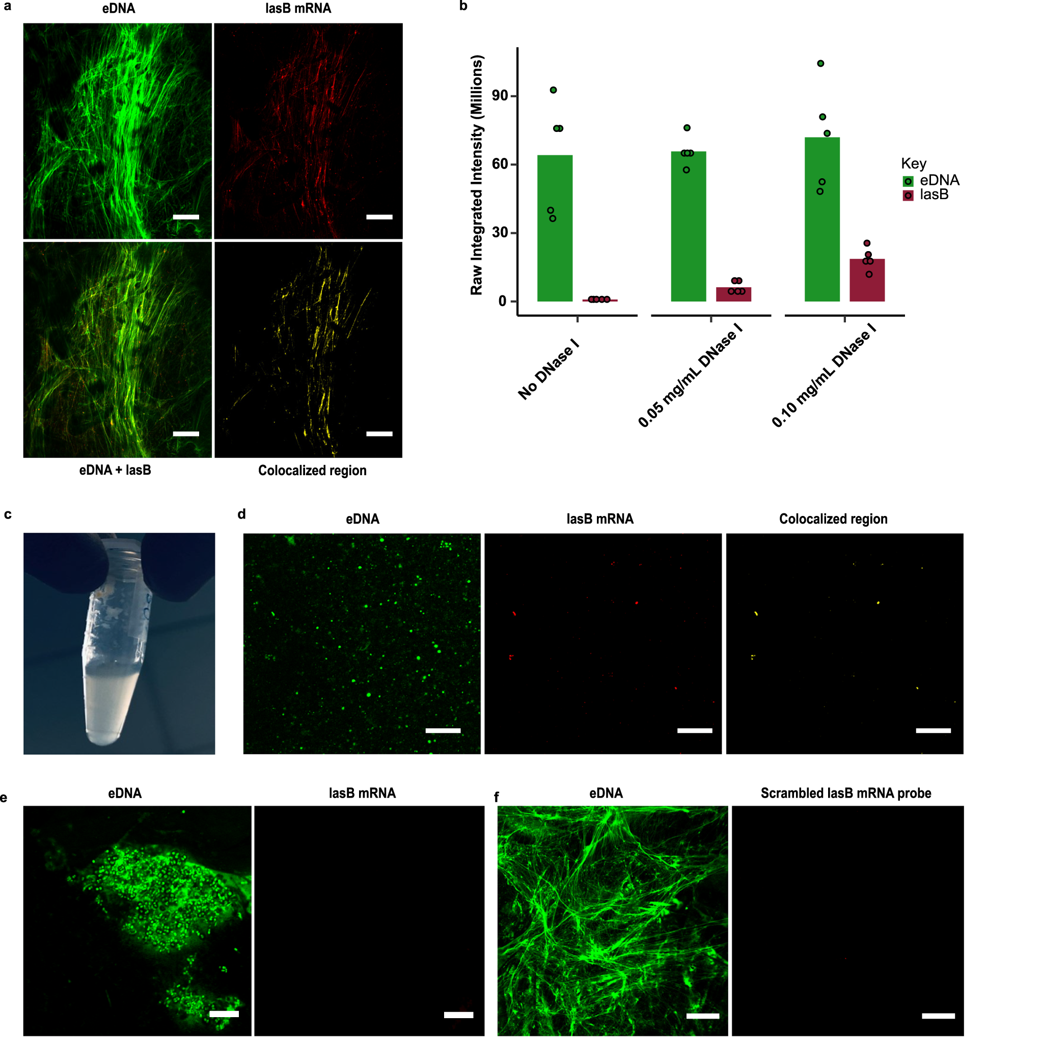 Fig. 5: lasB mRNA is also present in eDNA fibres of human clinical sputum sample.