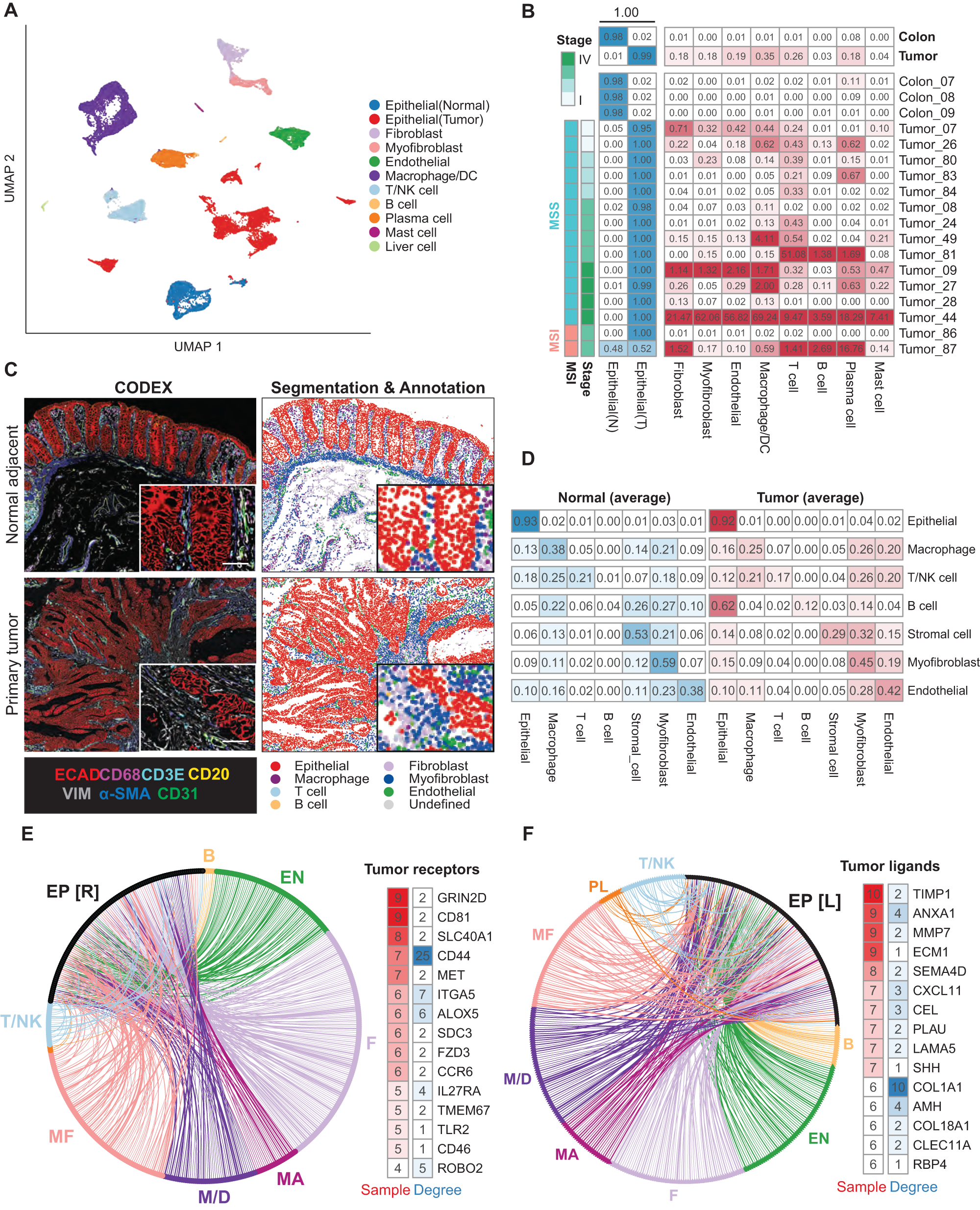 Fig. 2: Mapping carcinoma-TME interactions in human colorectal cancer.