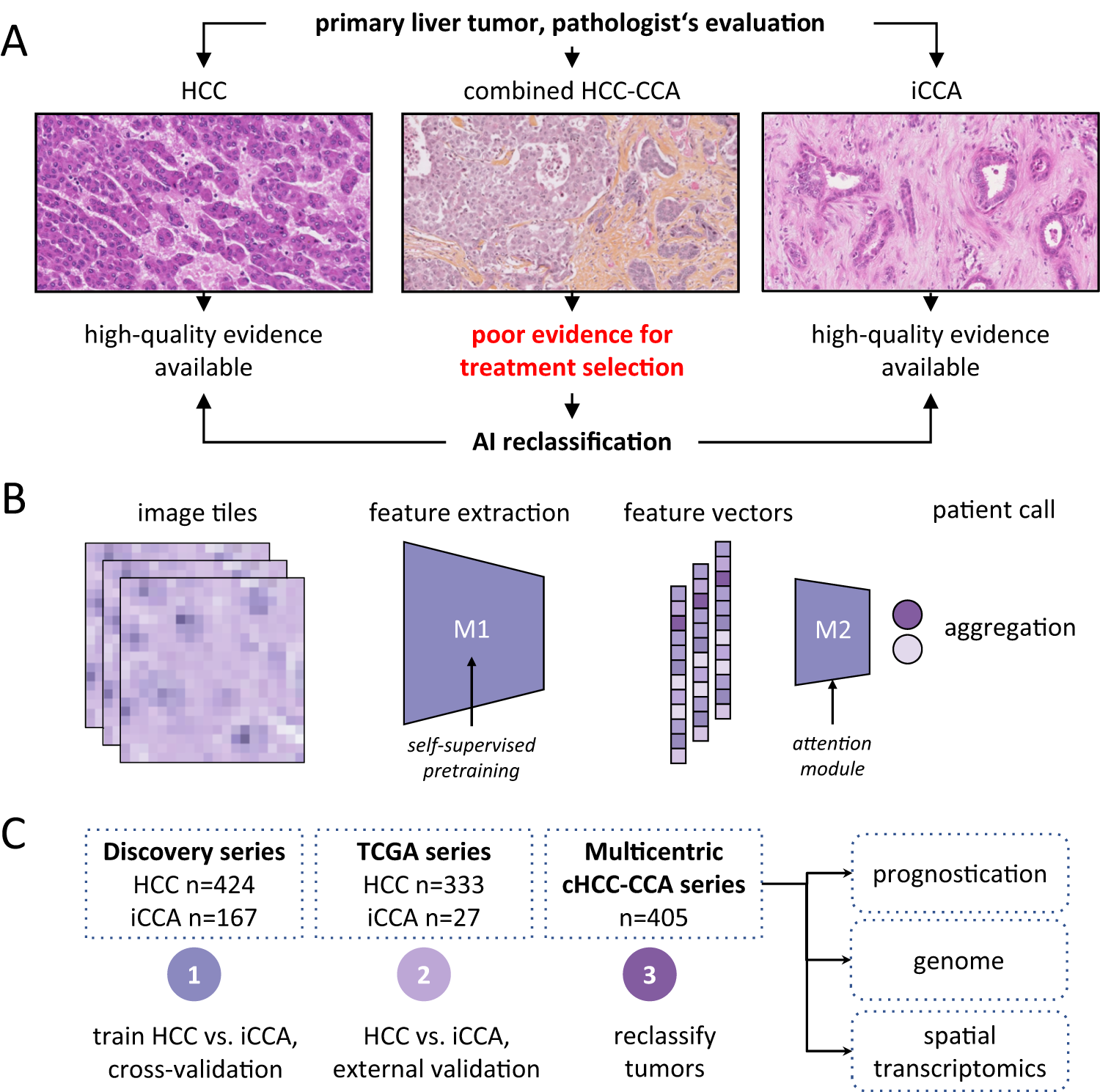 Fig. 1: Deep Learning-based classification of HCC versus ICCA.