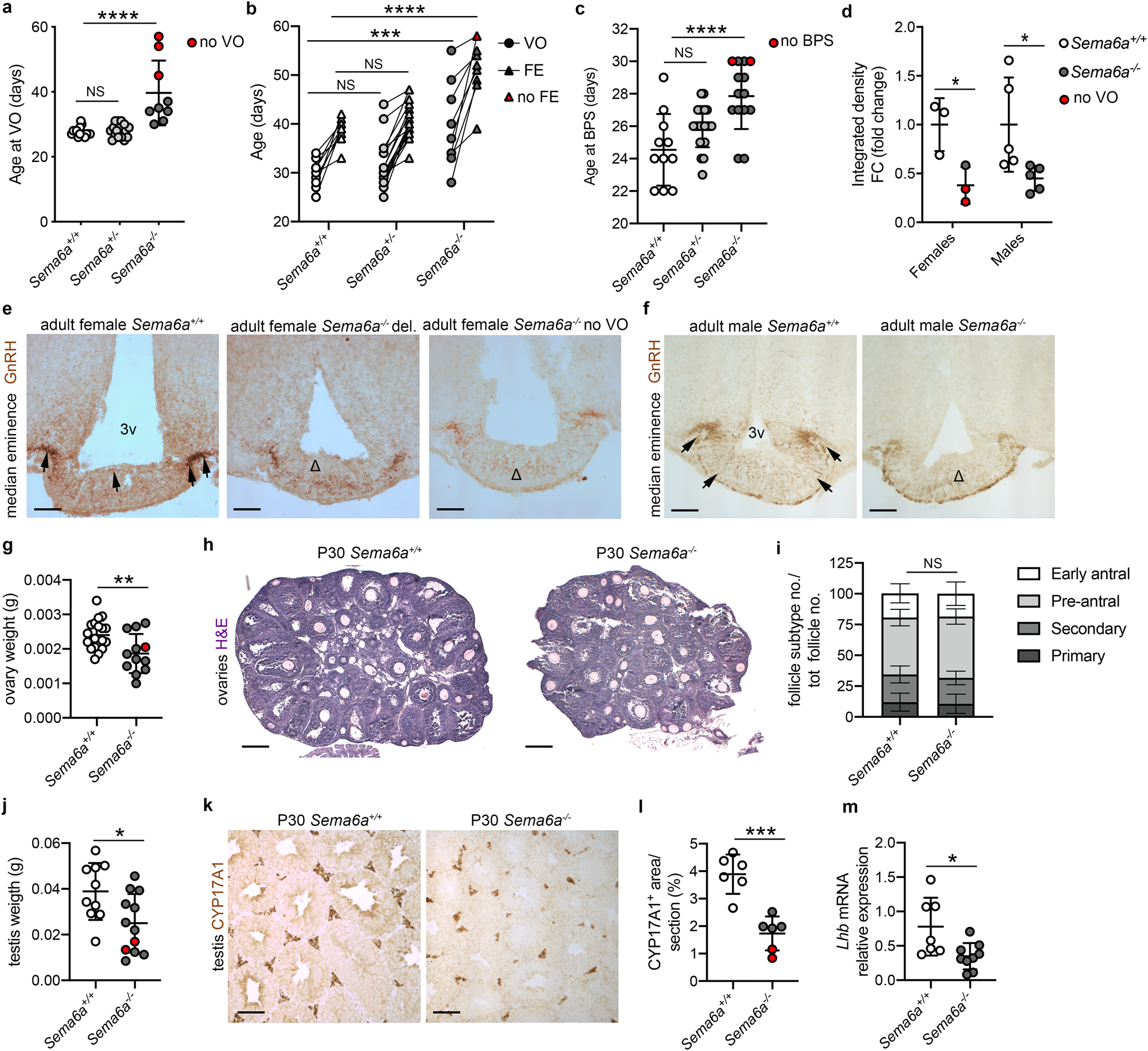 Fig. 4: SEMA6A loss delays puberty and gonadal maturation in female and male mice.