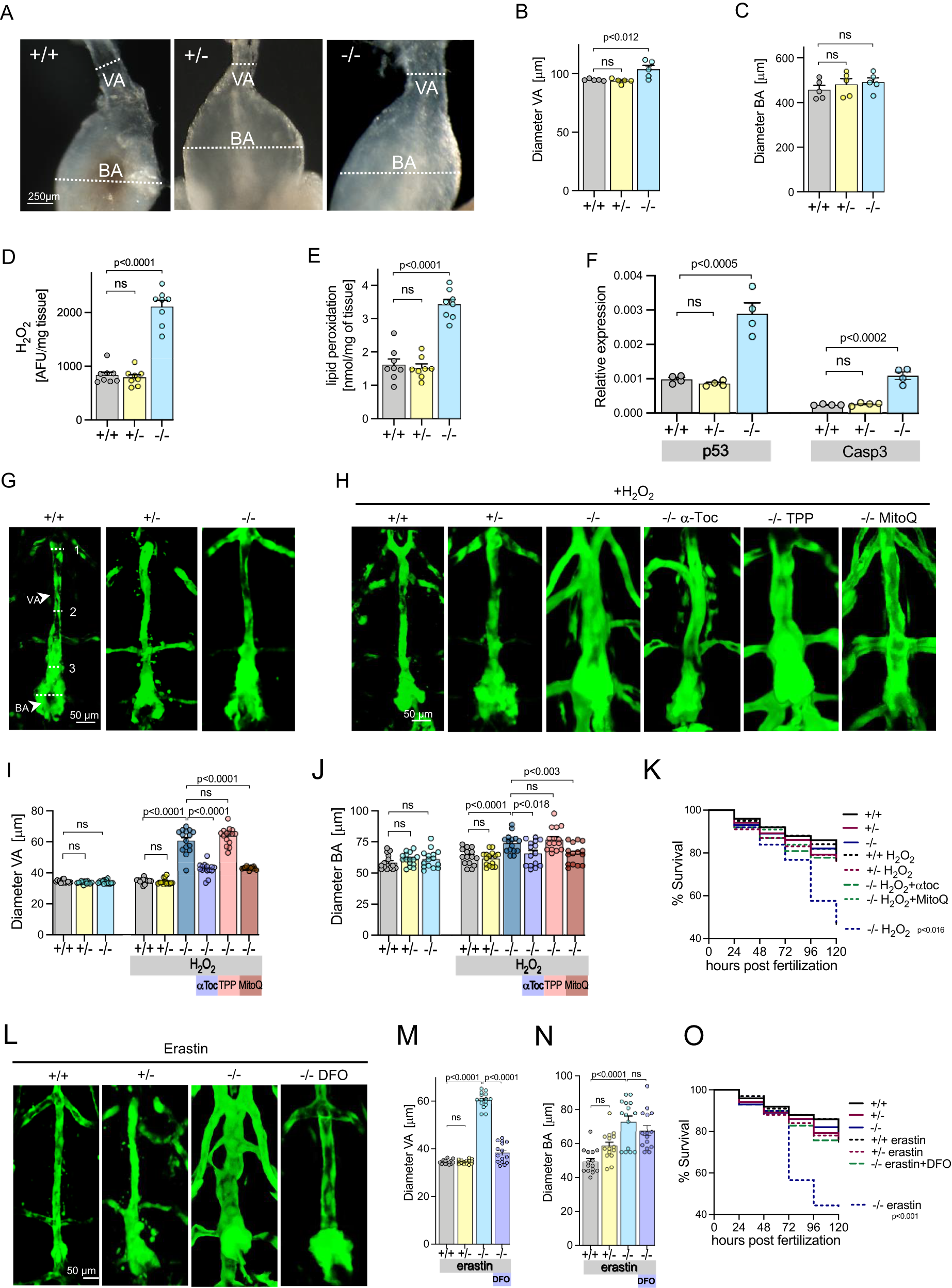 Fig. 3: Aortic abnormalities in Secisbp2 mutant zebrafish.