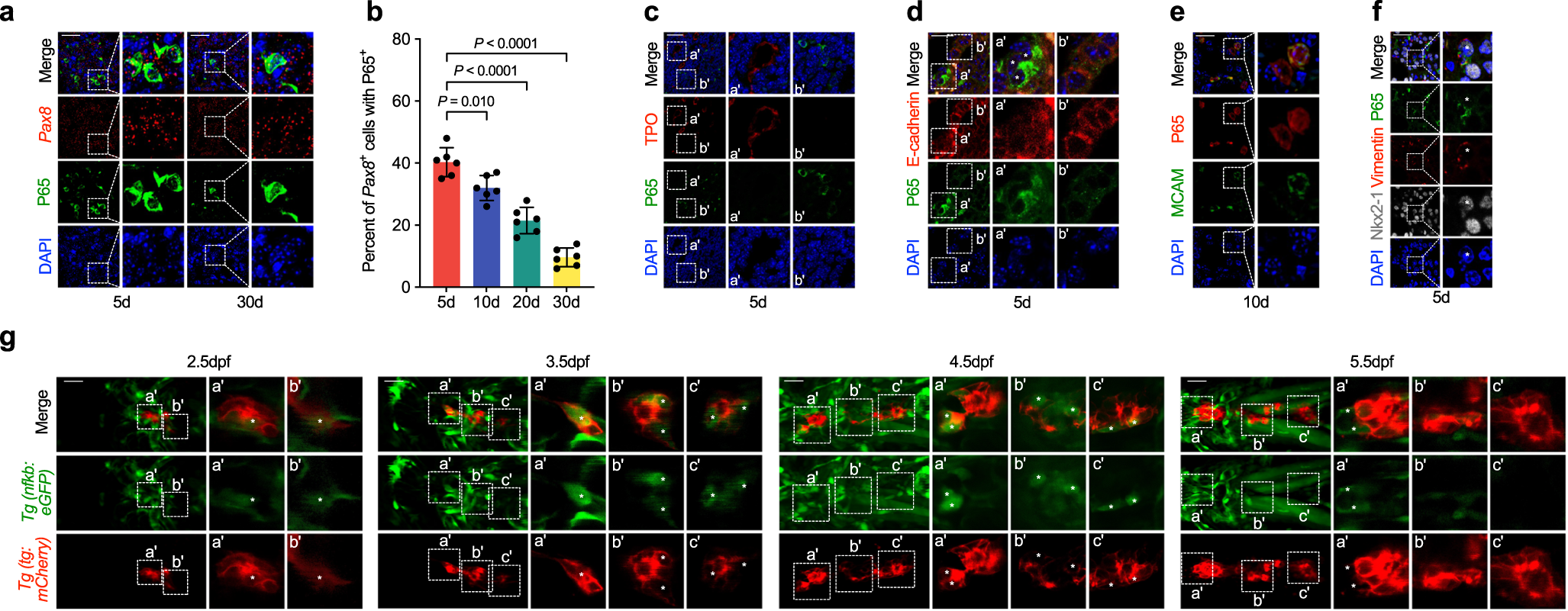 Fig. 4: NF-κB signaling is activated in TFC with higher migratory capacity in zebrafish and mice.