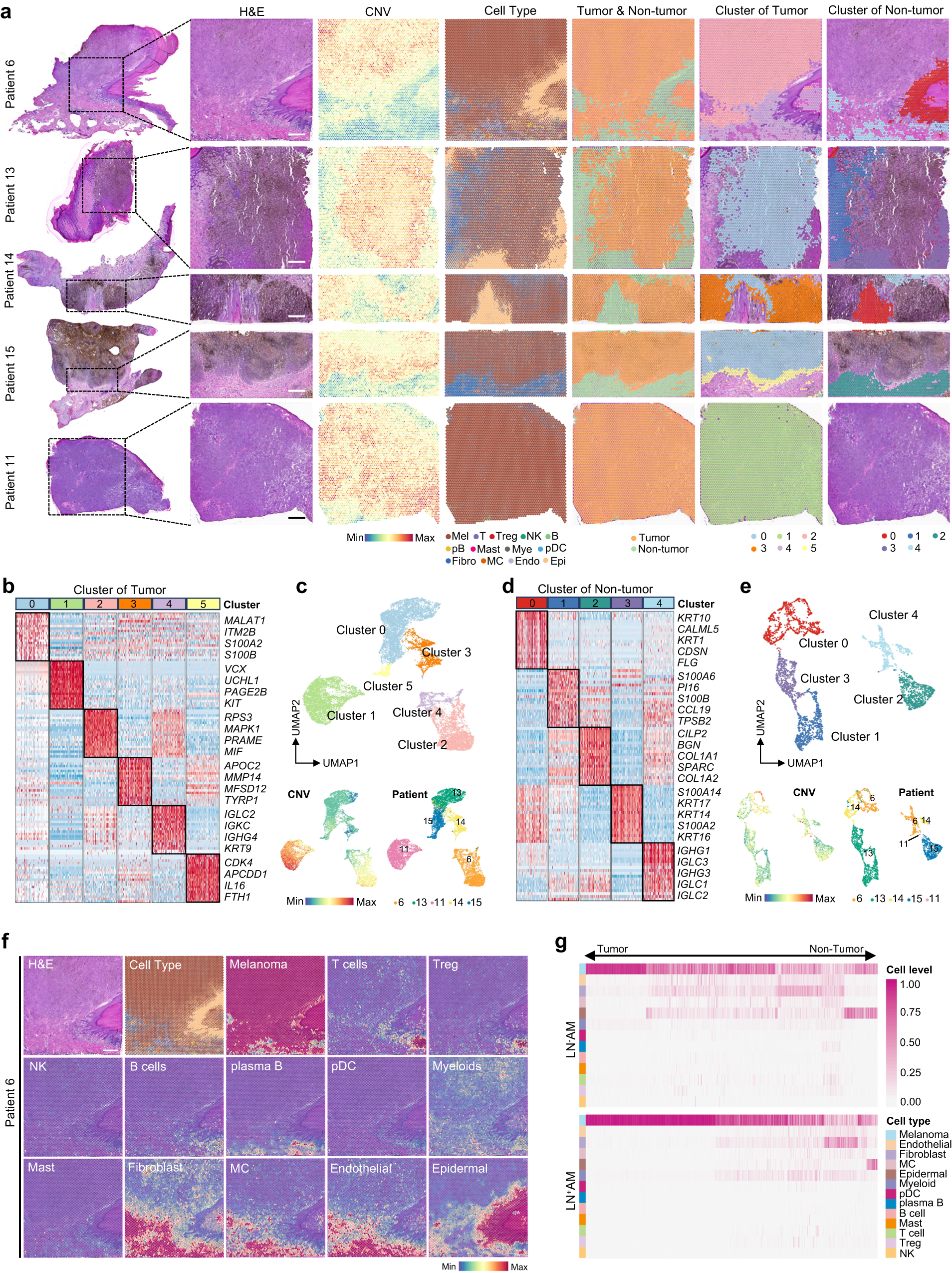 Fig. 2: Spatial transcriptome suggests a “cold” TME in AM.