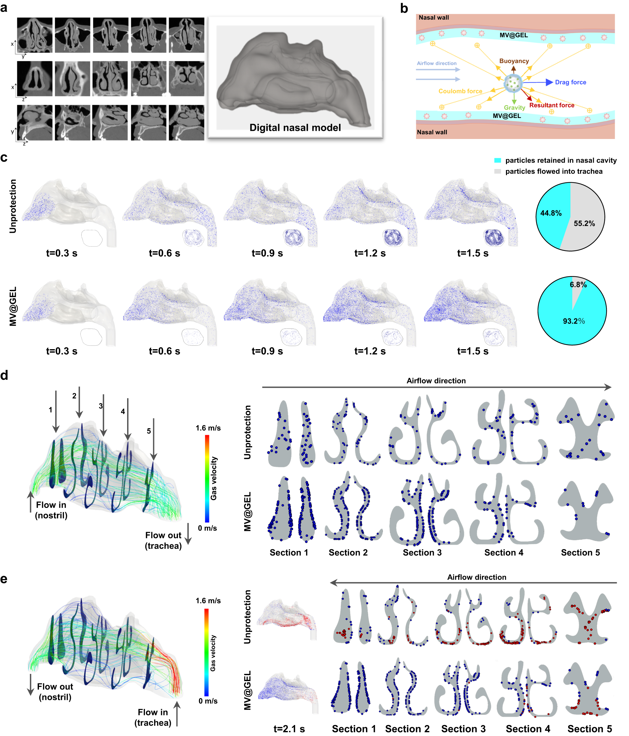 Fig. 6: Prediction of viral aerosol interception effect of MV@GEL in human digital nasal cavity by using computational fluid dynamics-discrete particle simulation (CFD-DPS).