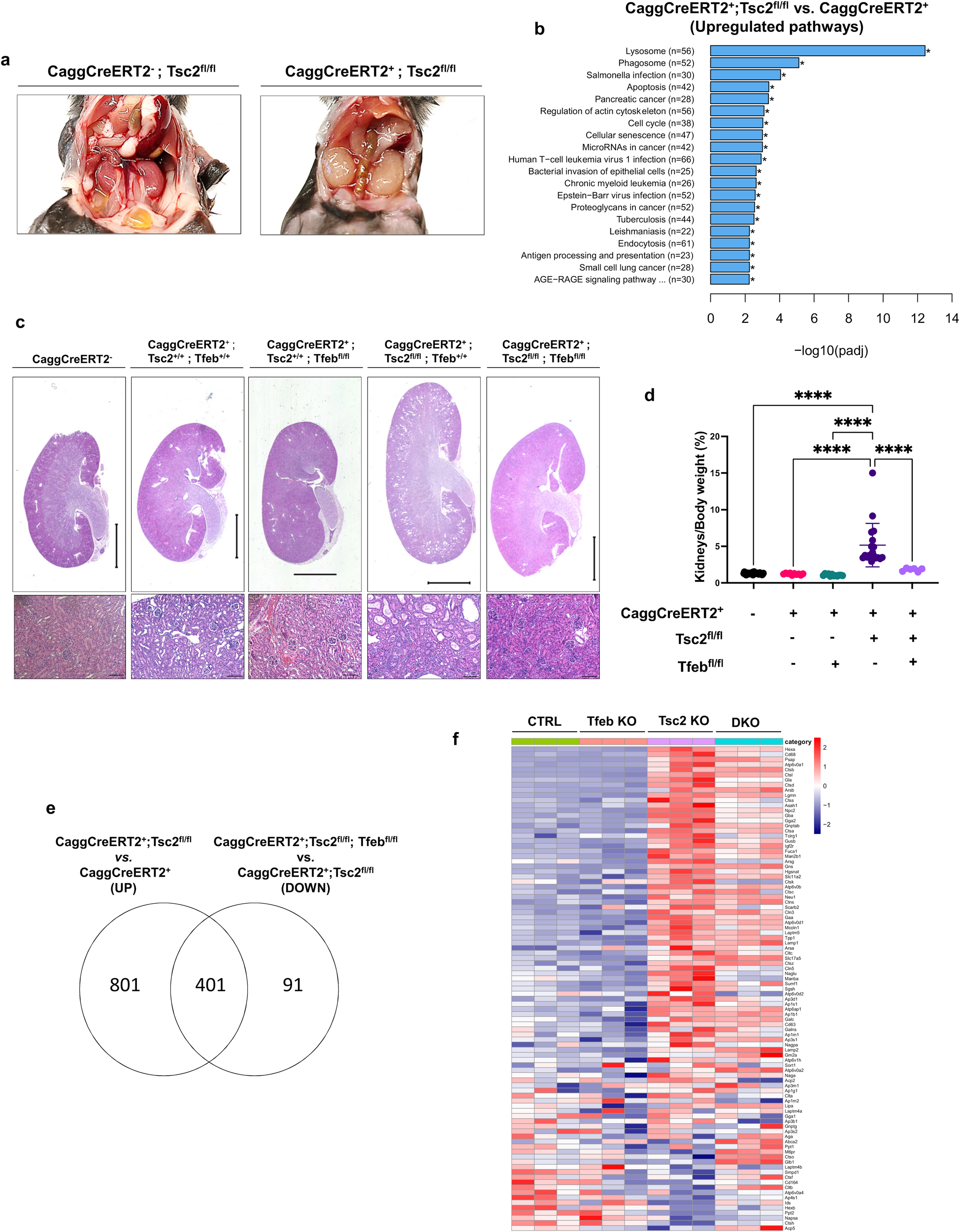 Fig. 1: TFEB knockout rescues renal pathology in a global inducible mouse model of TSC.