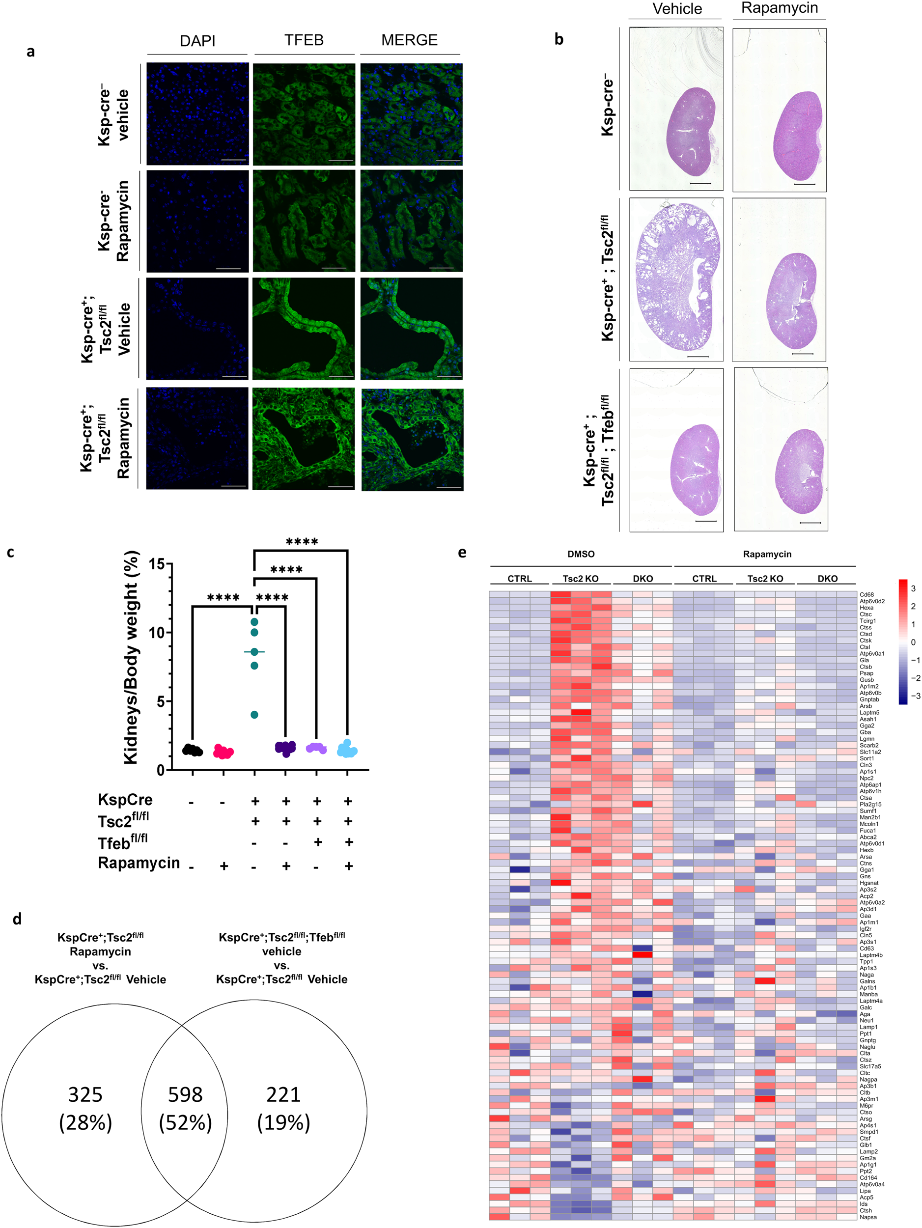 Fig. 5: The effect of Rapamycin in TSC is mediated by TFEB.