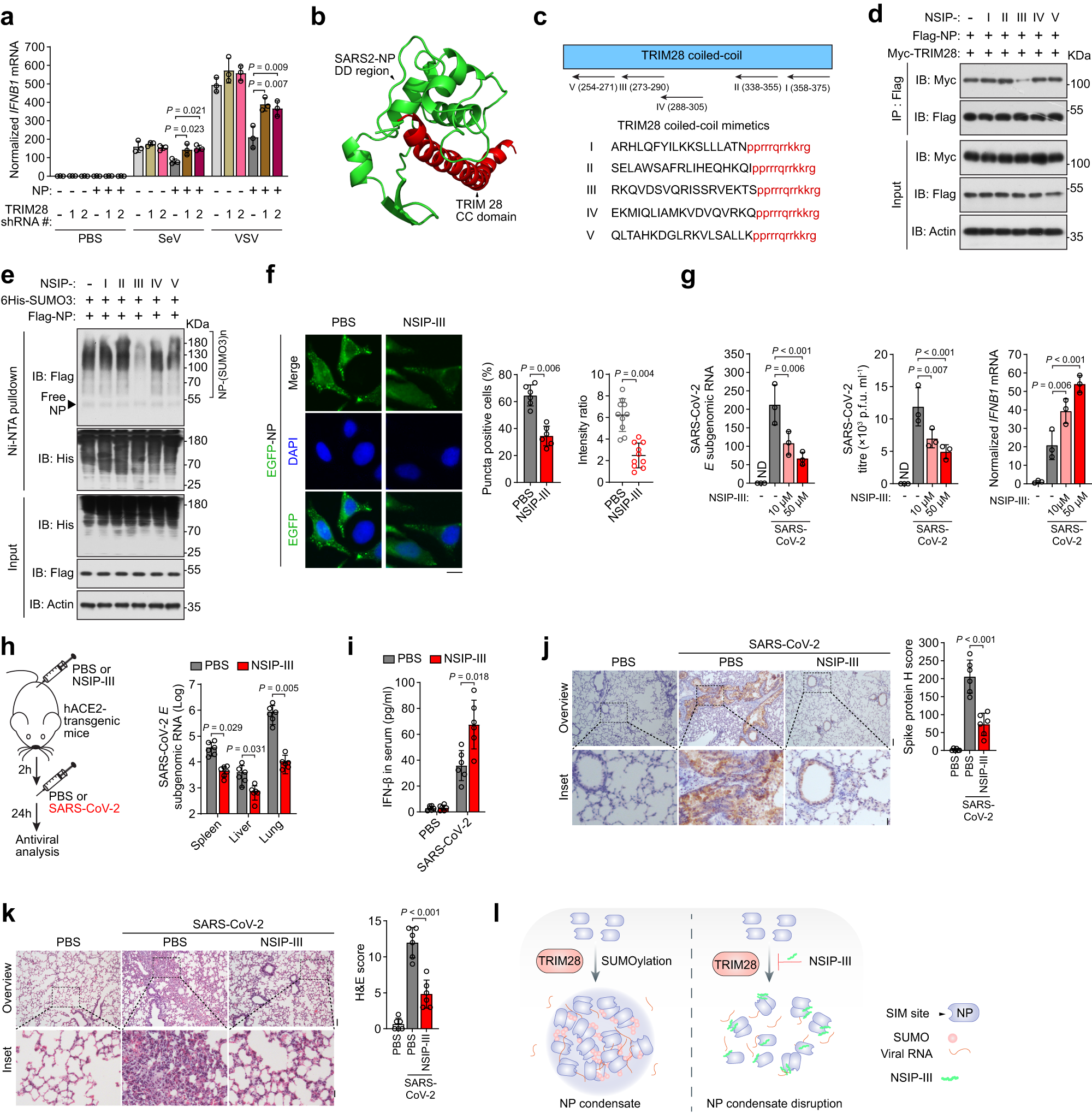 Fig. 8: The peptide NSIP-III disrupts SUMOylation and LLPS of SARS2-NP, thereby relieving immunosuppression.