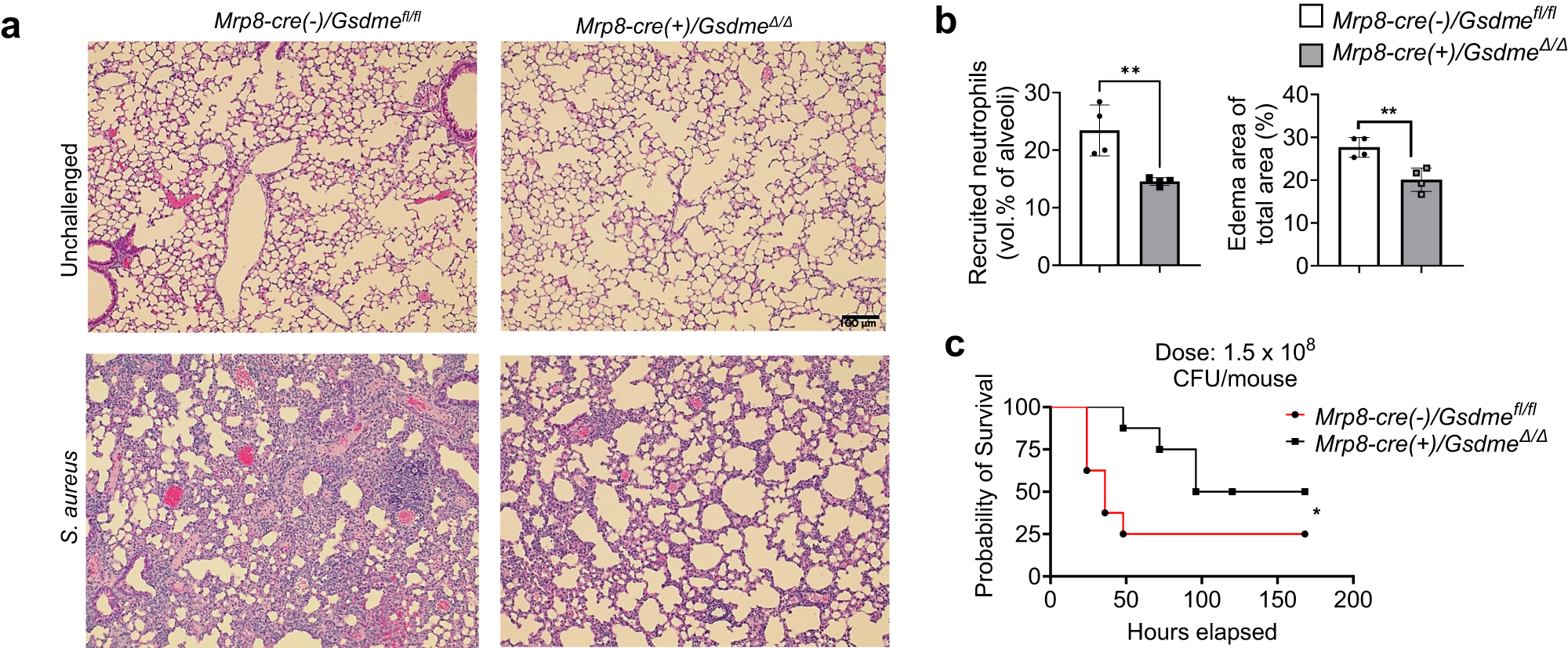 Fig. 9: GSDME disruption in neutrophils alleviated lung injury during S. aureus-induced pneumonia.