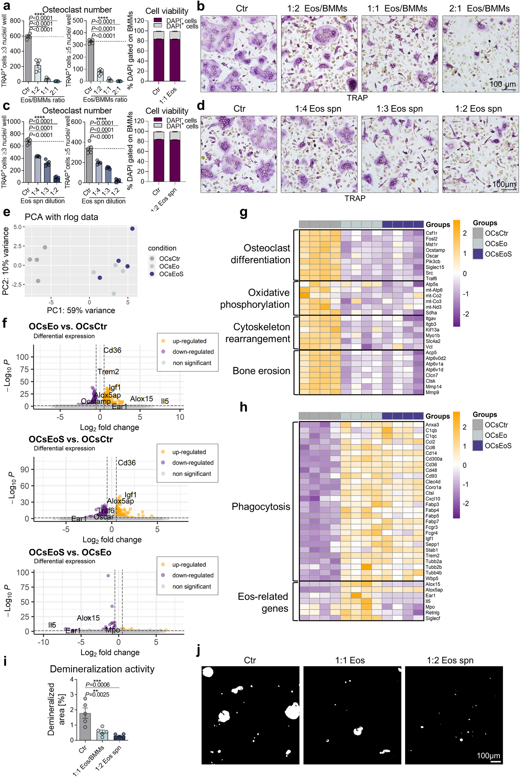 Fig. 3: Eosinophils inhibit osteoclast differentiation and function in vitro.